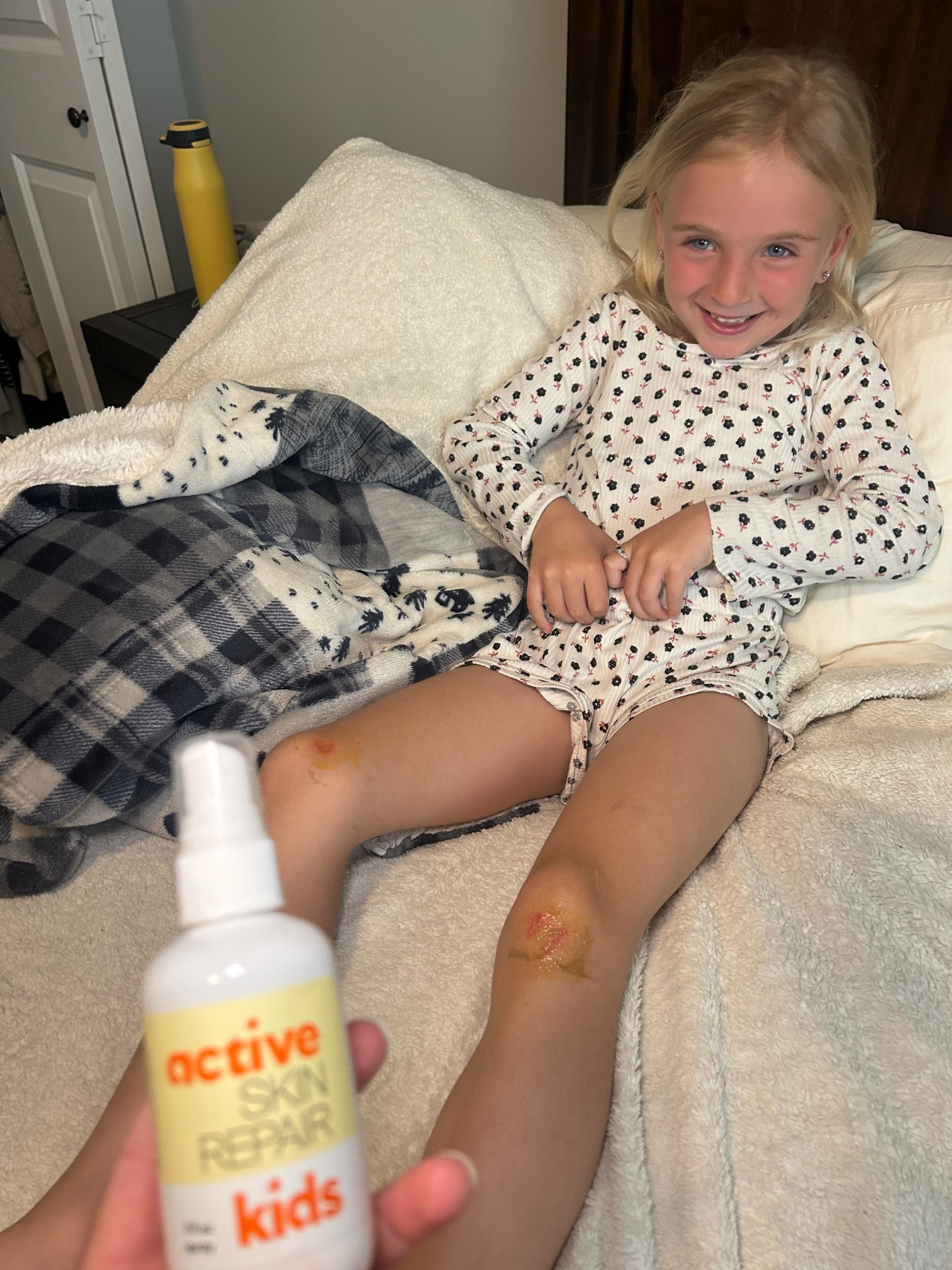 Cue scraped knee season. 🩹
This little spray has earned permanent purse status. Boo-boos, bug bites, scrapes, random rashes it’s my low-tox go-to for everything.
Linked on my LTK because every mama needs this in her bag.

#MomBagEssentials #LowToxHealing #CleanFirstAid #ToddlerMomLife #NaturalRemedies #MomHackApproved #LTKmama #StayAtHomeMomLife #EverydayMotherhood

#LTKTravel #LTKActive #LTKKids