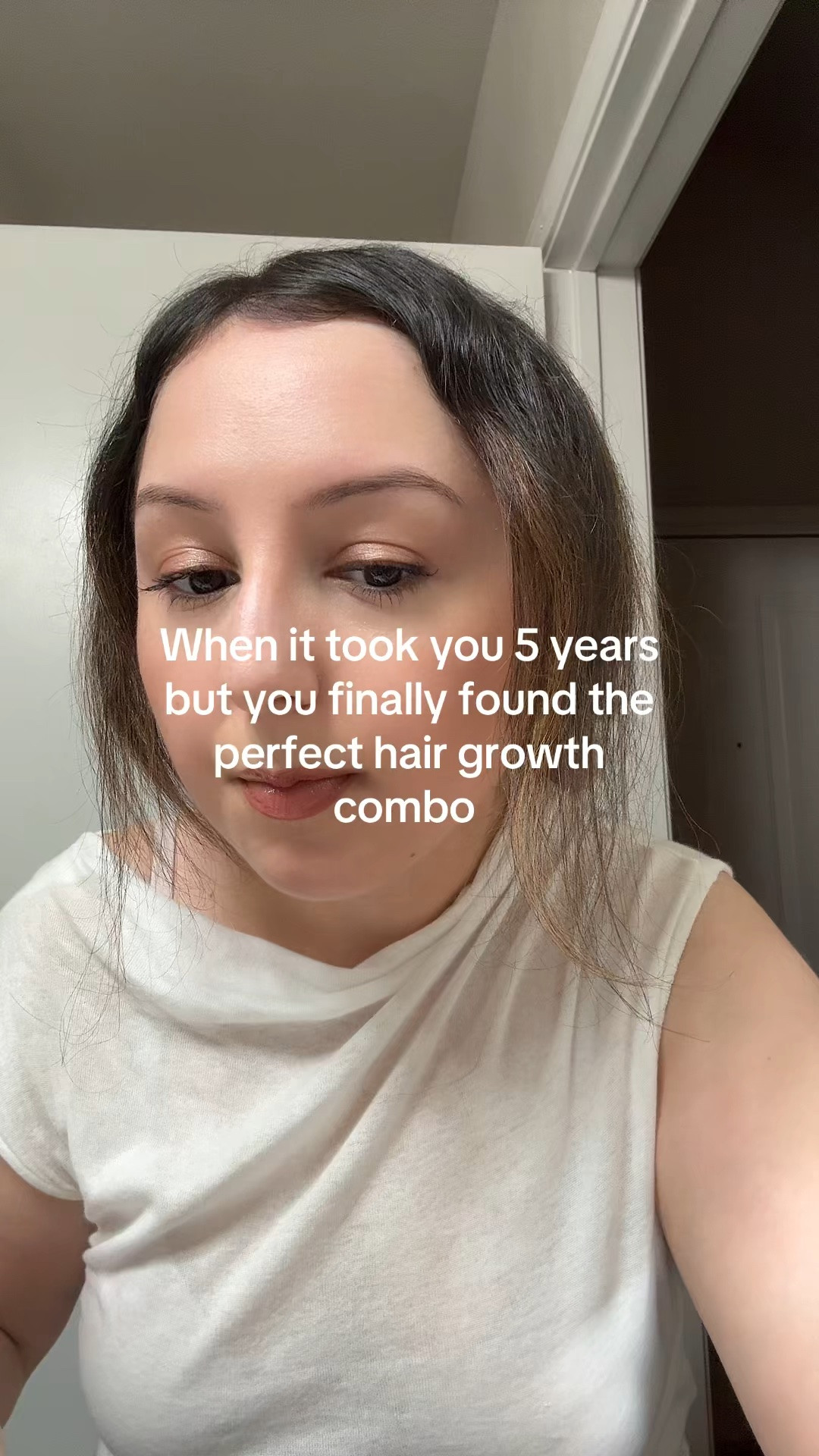 Current hair growth routine: Redken Extreme Length Shampoo and Conditioner, Cecred Hair Drops (after every wash) and Nutrafol Vegan Supplements (I take 2 pills instead of 4 and still see a big difference) ✨


#hairgrowth #hairloss #finehair #nutrafol #redken #cecred #nutrafol

#LTKBeauty #LTKSaleAlert