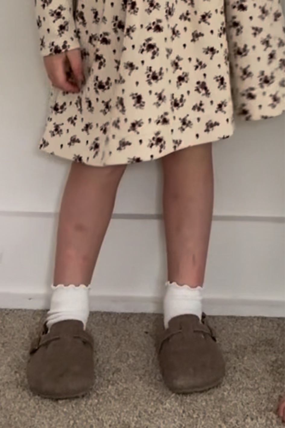 Similar clogs