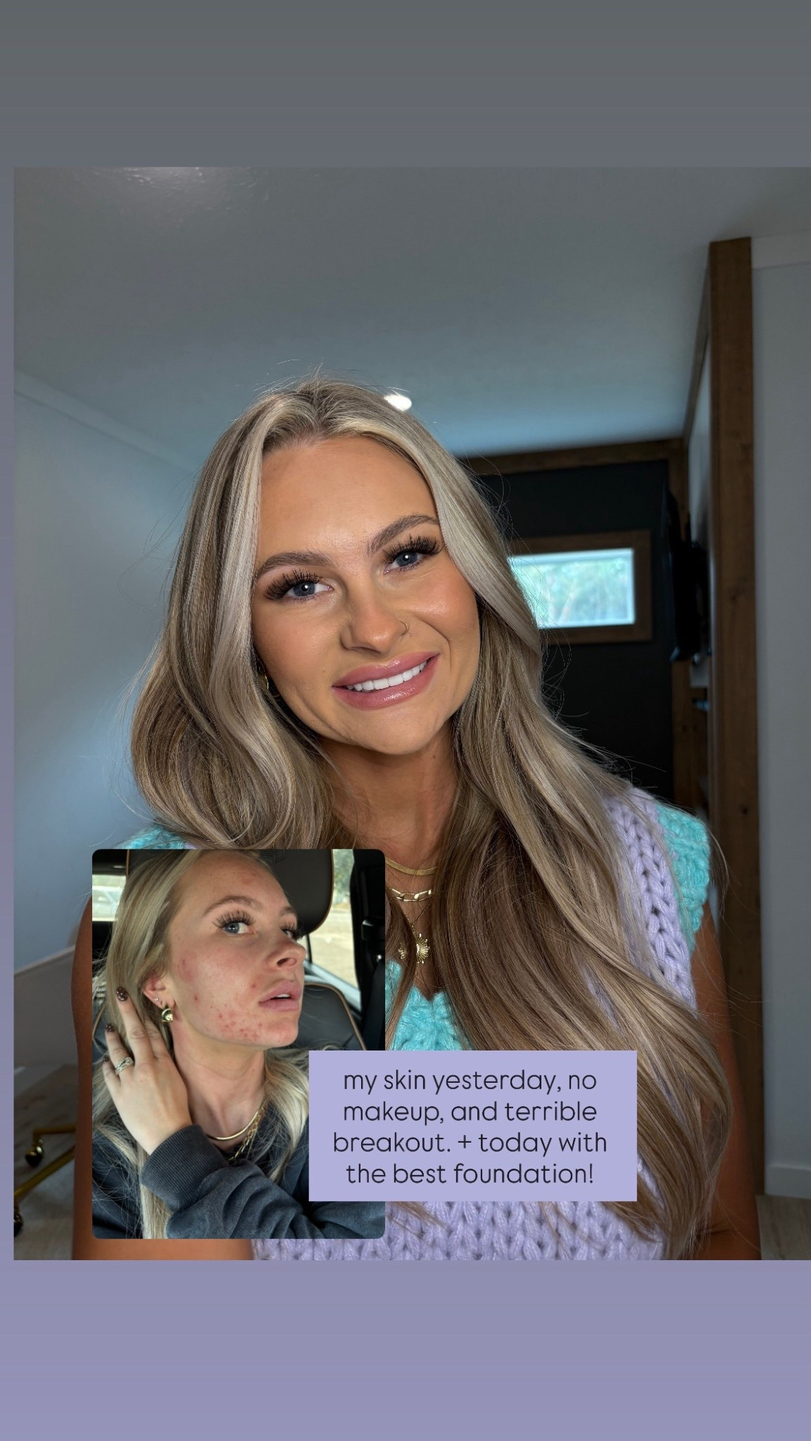 Makeup before and after! Using all my everyday products 🤍

#LTKgrwm #LTKBeauty #LTKselfcare