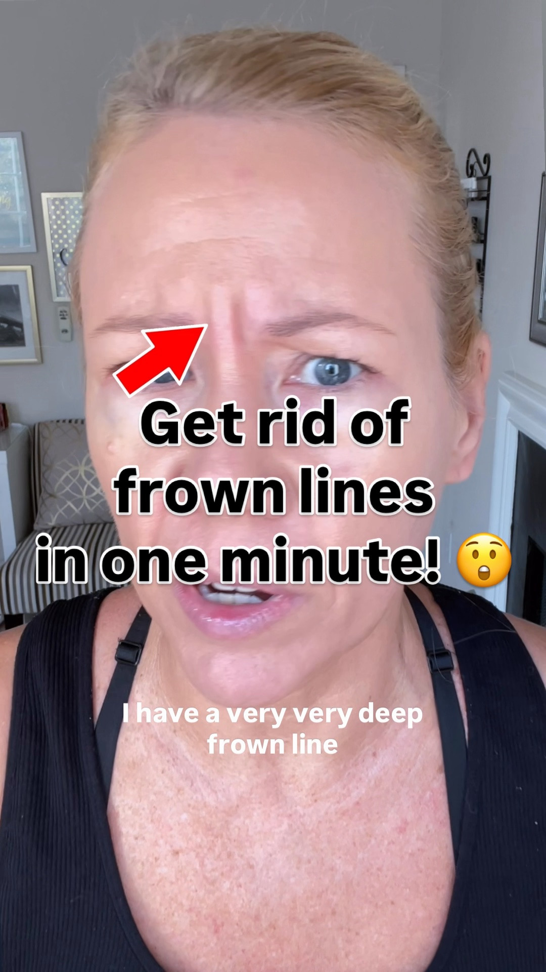 😡Get rid of your frown lines in ONE MINUTE! This really works but it needs practice!!! YOU WILL MESS UP THE FIRST COUPLE OF TRIES!!! I can do it now in my sleep lmao. I like to do this for special events, so I don’t look angry in all the pictures.

#LTKgrwm #LTKmorningroutine #LTKOver40