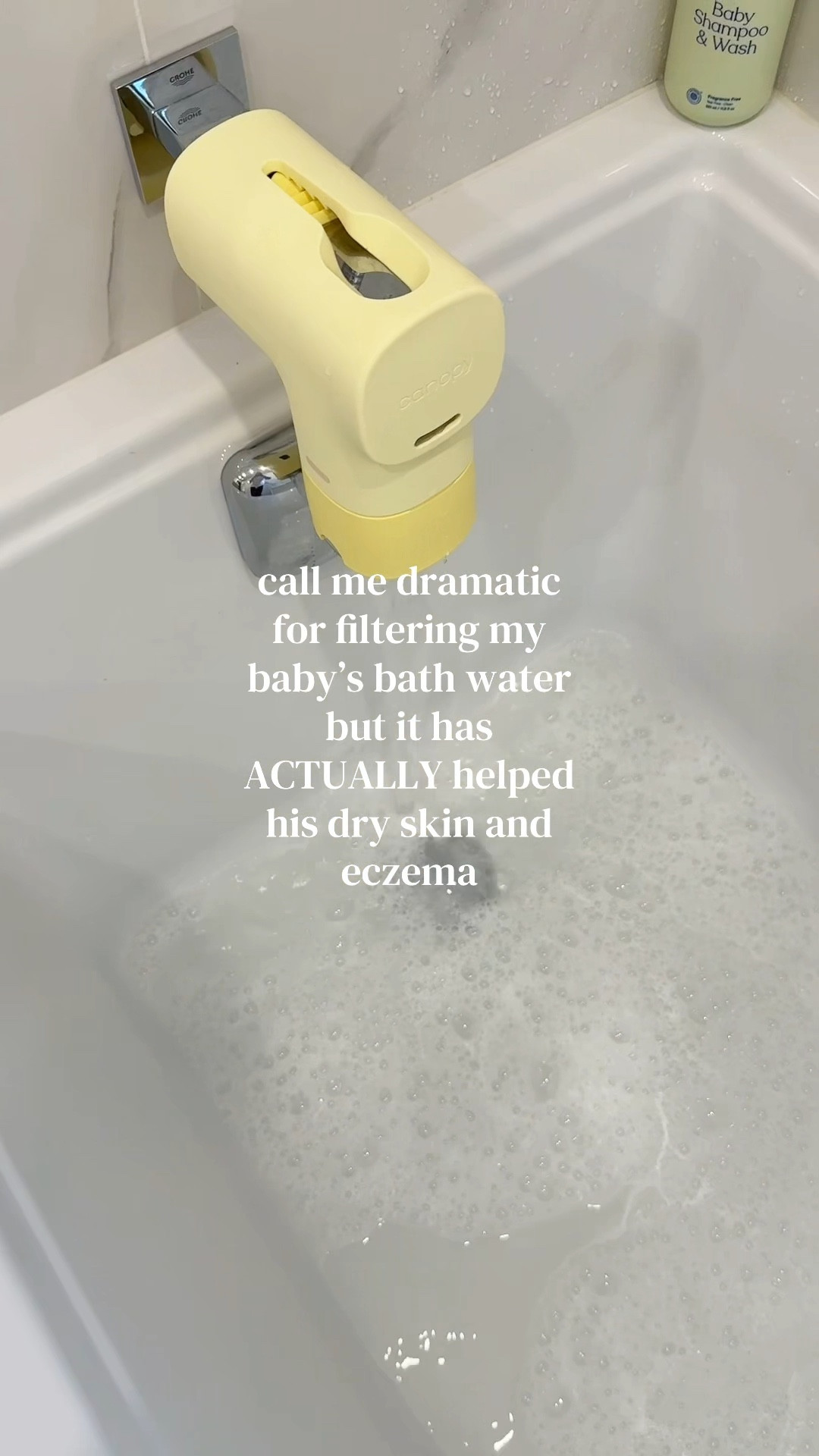 HIS skin has literally never been softer & im sorry if I can remove the chlorine and hard materials in our bath so his delicate baby skin can be safe so be it. Ill forever protect my babies with anything I can 🥺

#eczema #eczemaflareup #babyeczema #waterfilter #skincare #babycare #chlorinefree #sensitivebaby #healthybath 

#LTKKids #LTKBump #LTKBaby