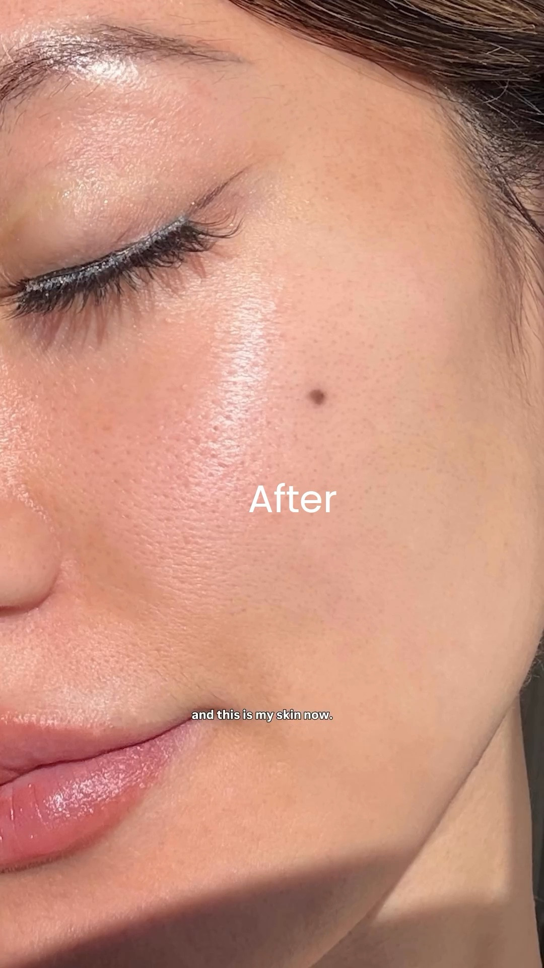 My secret barrier repairer and glass skin 🫶

#LTKBeauty #LTKmorningroutine #LTKselfcare