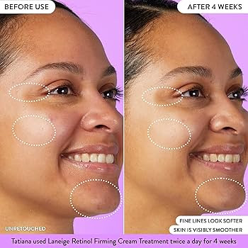 LANEIGE Retinol Firming Cream Treatment: Visibly firm and smooth the look of fine lines and wrink... | Amazon (US)
