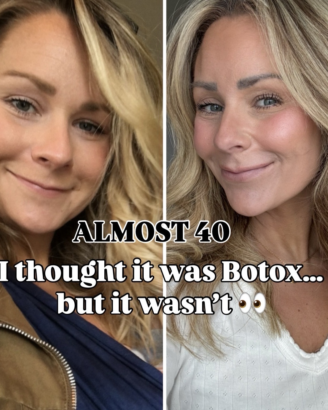 I’m just gonna say it…
yes, I get Botox 💉

But only like twice a year… and it’s honestly NOT what made the biggest difference in how my skin looks now.

I used to think I needed more treatments, more products, more everything…

but what actually changed everything was a few small things I started doing consistently.

That’s when my skin got smoother, brighter, and just looked… healthier.

Now I feel like I look better than I did a few years ago (which still shocks me tbh)

If you want my exact routine + everything I use (daily + weekly), I’ll send it to you 🤍

