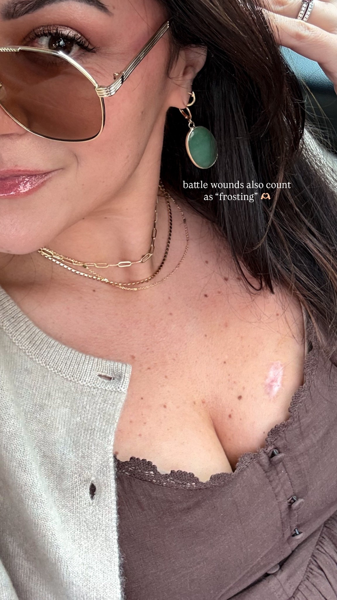 the scars that shaped us don’t need to be hidden. 🫶🏻
it’s been a year since my last skin cancer scare. it’s taken me a while to get to a place of wanting to cover this new battle wound. it’s a reminder i’ve lived, and a reminder i made some terrible choices (im looking at you tanning beds). 

don’t forget to wear your sunscreen bestie. i linked some of my faves. 

#LTKMidsize #LTKOver40 #LTKdayinmylife