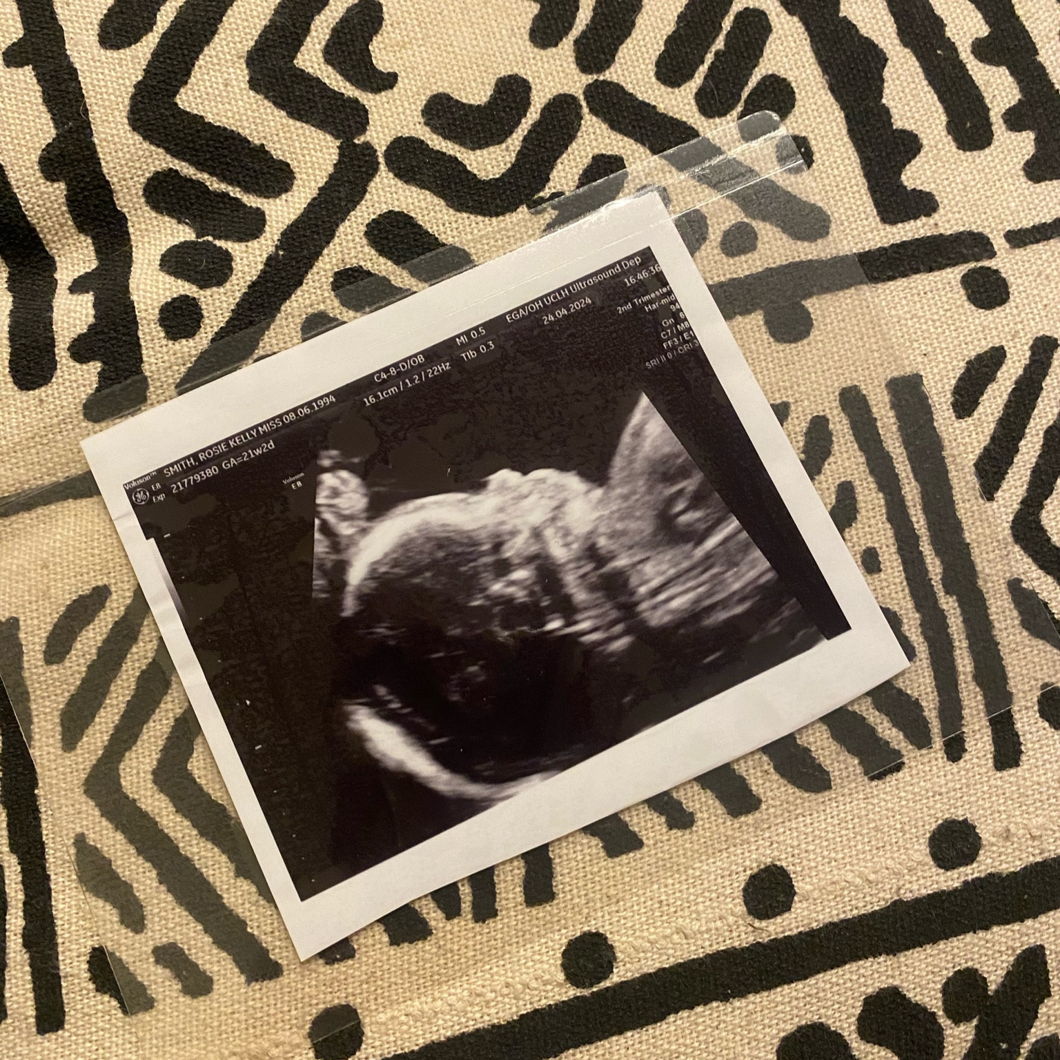 The best way to keep your scan photos safe ❤️

#LTKbaby #LTKbump #LTKkids