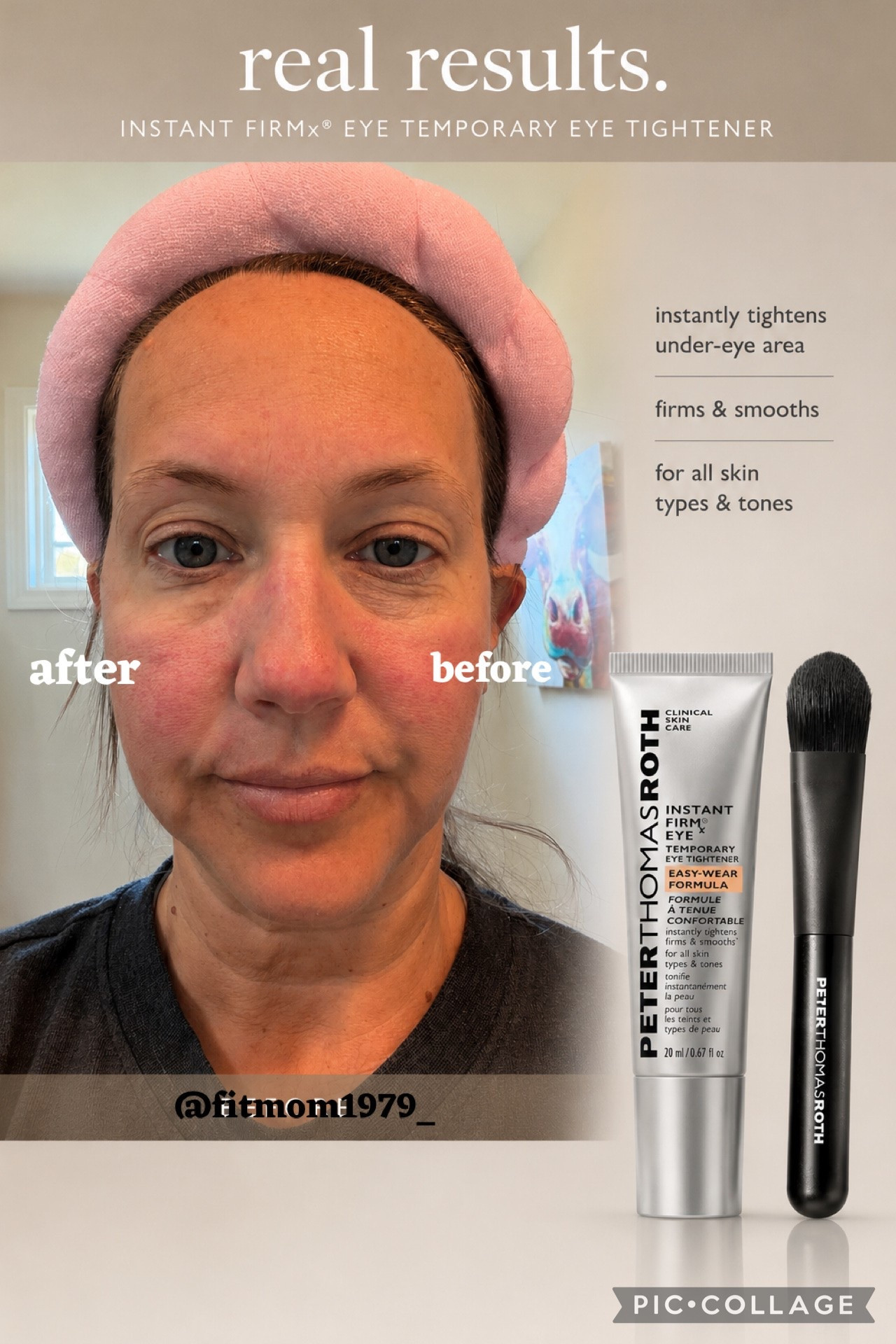 POV: you finally found an eye treatment that actually looks like you slept 8 hours 👀✨

I tried the Instant FIRMx® Eye Temporary Eye Tightener and the difference was visible in minutes — smoother, tighter, and brighter under-eyes without makeup or filters. 🙌

✔️ Instantly tightens
✔️ Smooths fine lines + puffiness
✔️ Perfect for busy moms, tired mornings & no-makeup days

This is officially my secret weapon for looking refreshed fast 💁‍♀️

Grab yours before everyone catches on 🛍️✨
Comment “LINK” and I’ll send it to you! #beautyhacks #skincaremusthave #beforeandafter #over40beauty #momlife #eyetightener

#LTKselfcare #LTKOver40 #LTKBeauty