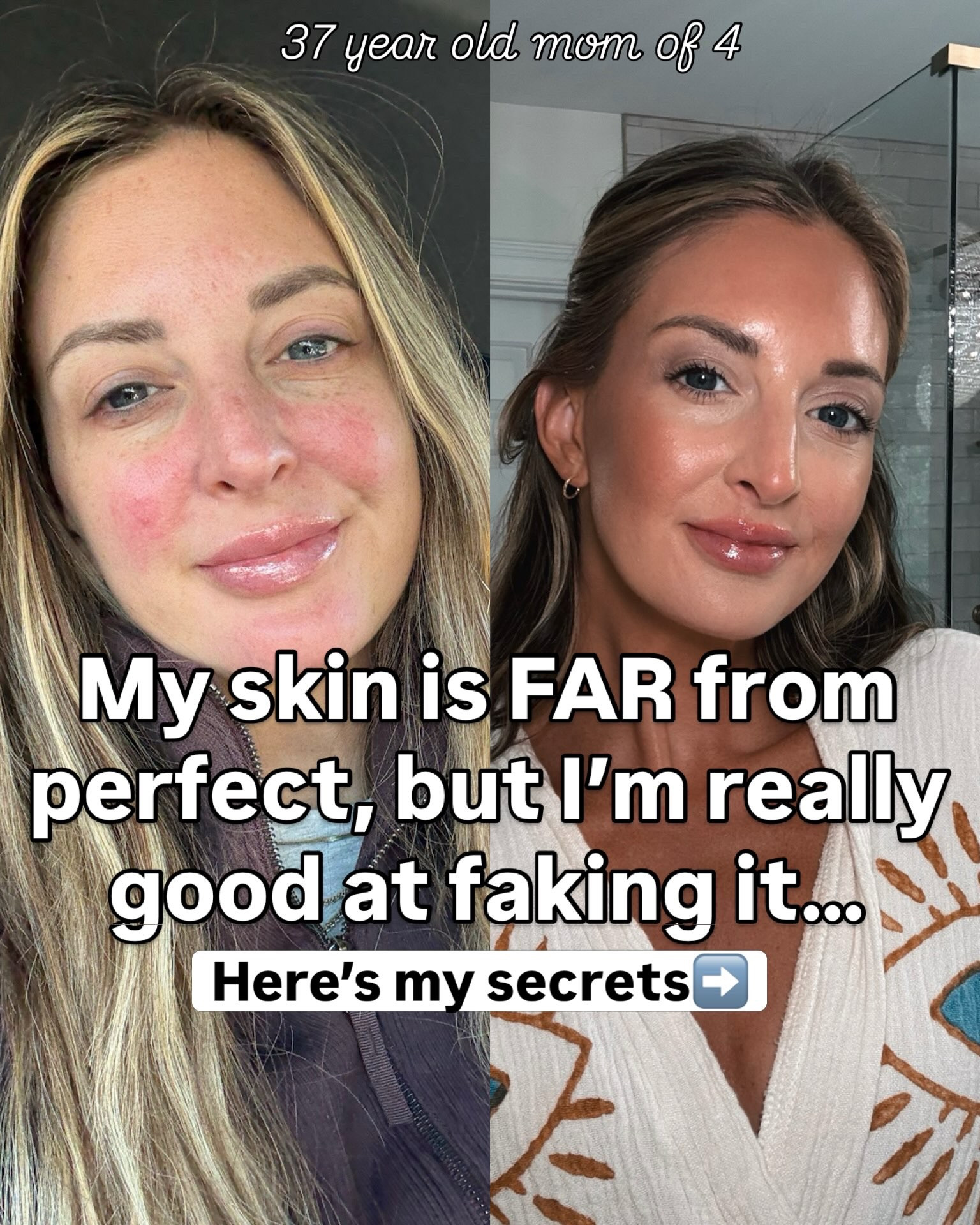As a rosacea, red, dry, textured girl these are some must haves in my skincare & beauty routine to keep my redness down& skin glowing!

#skincare #rosacea #beautymusthave

#LTKmorningroutine #LTKselfcare #LTKBeauty