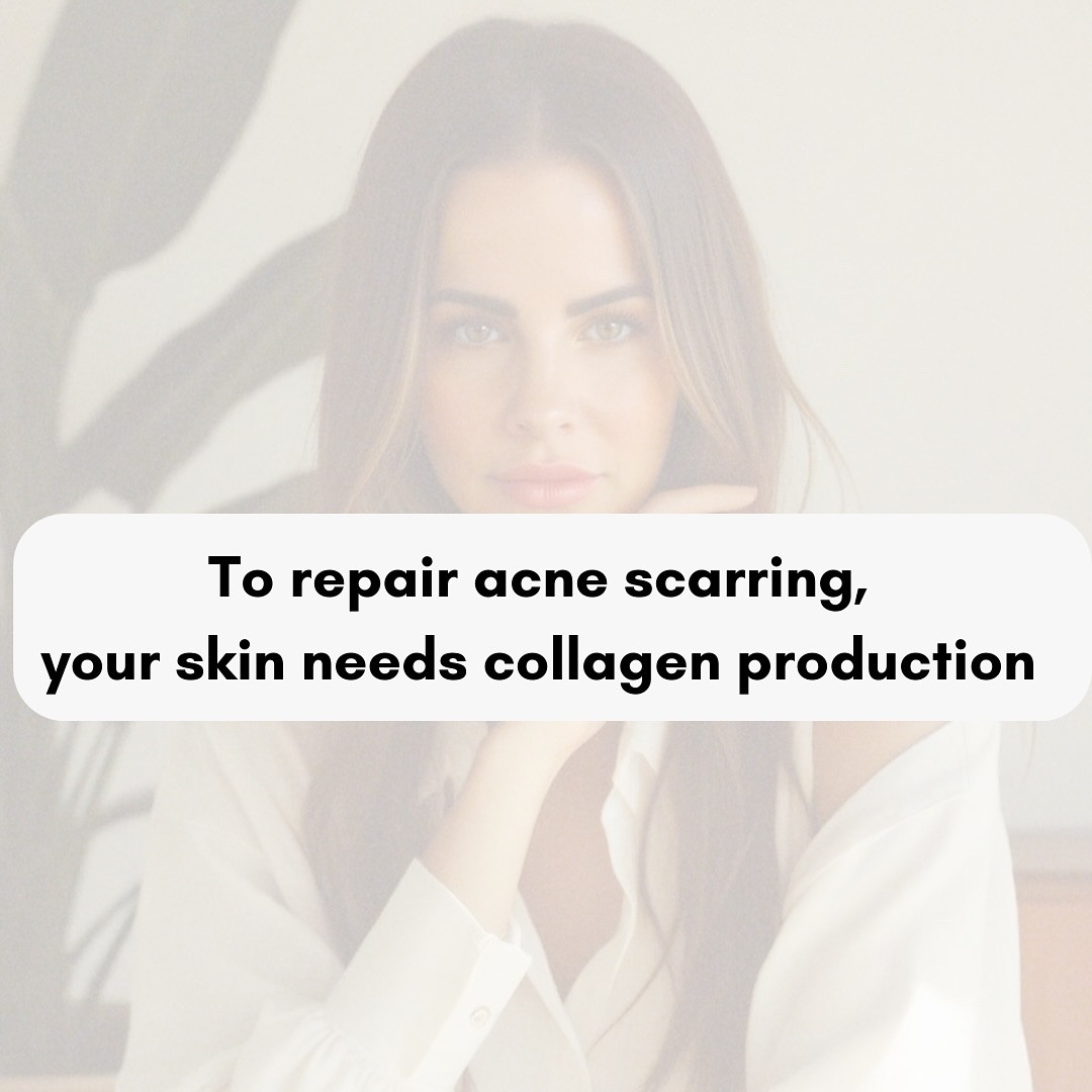 Your gut health is the foundation of your skin health—and if you’re struggling with acne scarring, fine lines, wrinkles, or rosacea, it’s time to heal from the inside out! This Elixir is packed with clinically proven ingredients that restore your gut, boost collagen production, and transform your skin at the cellular level. Say goodbye to dull, damaged skin and hello to a radiant, youthful glow! ✨

Drop the word “GLOW” in the comments to get yours today and start your skin transformation! 

Follow me for more skincare tips ✨

 #GlowFromWithin #CollagenElixir #GutHealthToGlowingSkin