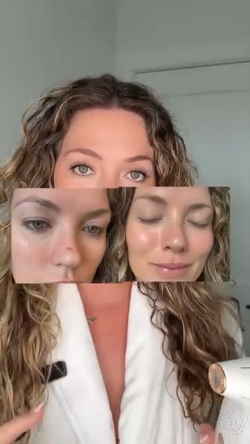 How I healed my facial scar! Dermrays Revive Laser 2.0 for skin rejuvenation. Just look at my before and after! It’s even FDA-cleared and currently the world’s most powerful at-home laser skincare device, outperforming other laser or light-based devices on the market, including brands like NIRA and LYMA. 
 This helps with improving the skin’s health and appearance. Ask your questions below:

@dermrays_global @dermrays_europe 

#dermrays #skincare #skincareforbeginners #instadaily #beauty