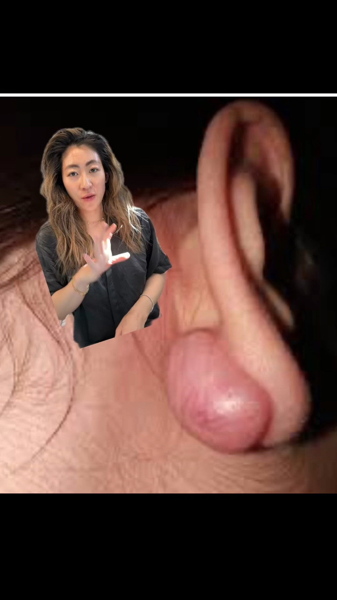 Keloid scar prevention/treatment! Using it for my c section scar but you can use it for any scars such as bug bites, scrapes, etc 

#LTKbump #LTKbeauty #LTKMostLoved