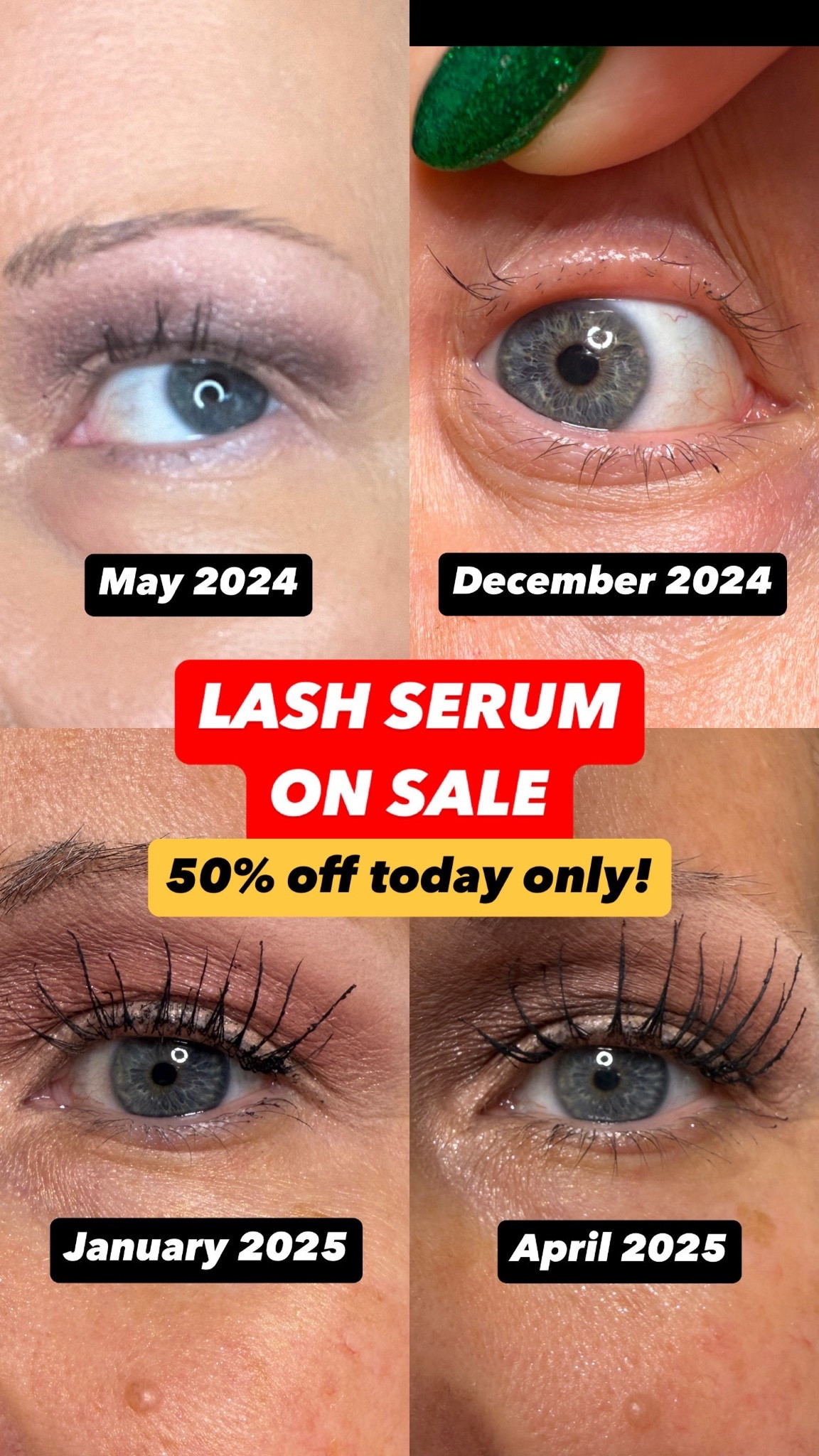 My lashes all fell out out of nowhere in 2024 (literally, I have no idea what happened), and I started using this serum and they grew back MUCH longer- even longer than the lash strips I was wearing in the meantime. I still use this serum a few times a week. I am also going to try the brow serum since I clearly need it - its also 50% off today, too. 😂

#LTKBeauty #LTKSaleAlert