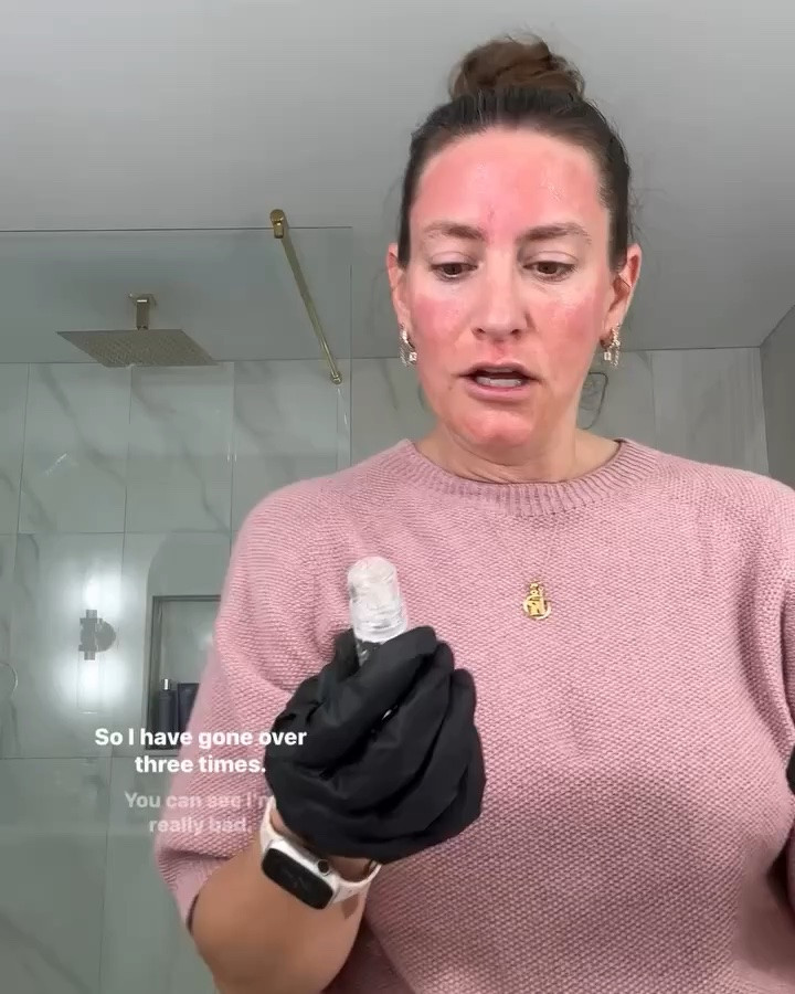 Part Nine: Seranova Microneedling

The overall review

#LTKselfcare