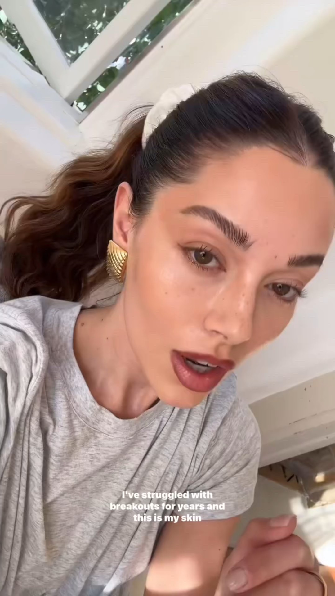 My most asked question- what are my favorite acne safe products? Here are my favorite acne safe foundations. Non pore clogging ingredients that cover!

Let me know what product category you want my to cover next.
Xx

#LTKBeauty #LTKFindsUnder100 #LTKSeasonal