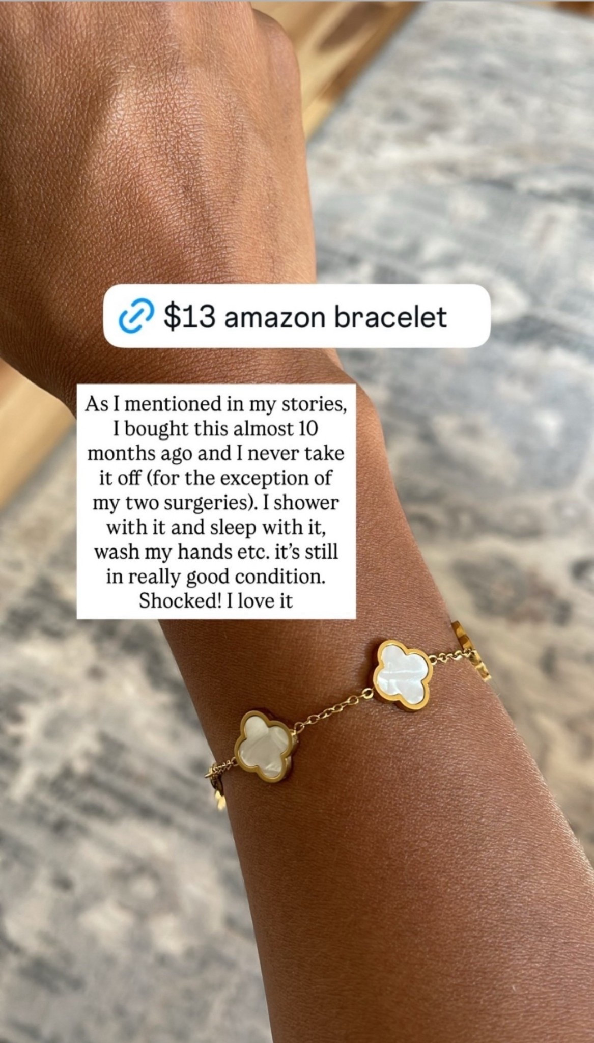 As I mentioned in my stories, I bought this almost 10 months ago and I never take it off (for the exception of my two surgeries). I shower with it and sleep with it, wash my hands etc. it’s still in really good condition. Shocked! I love it

