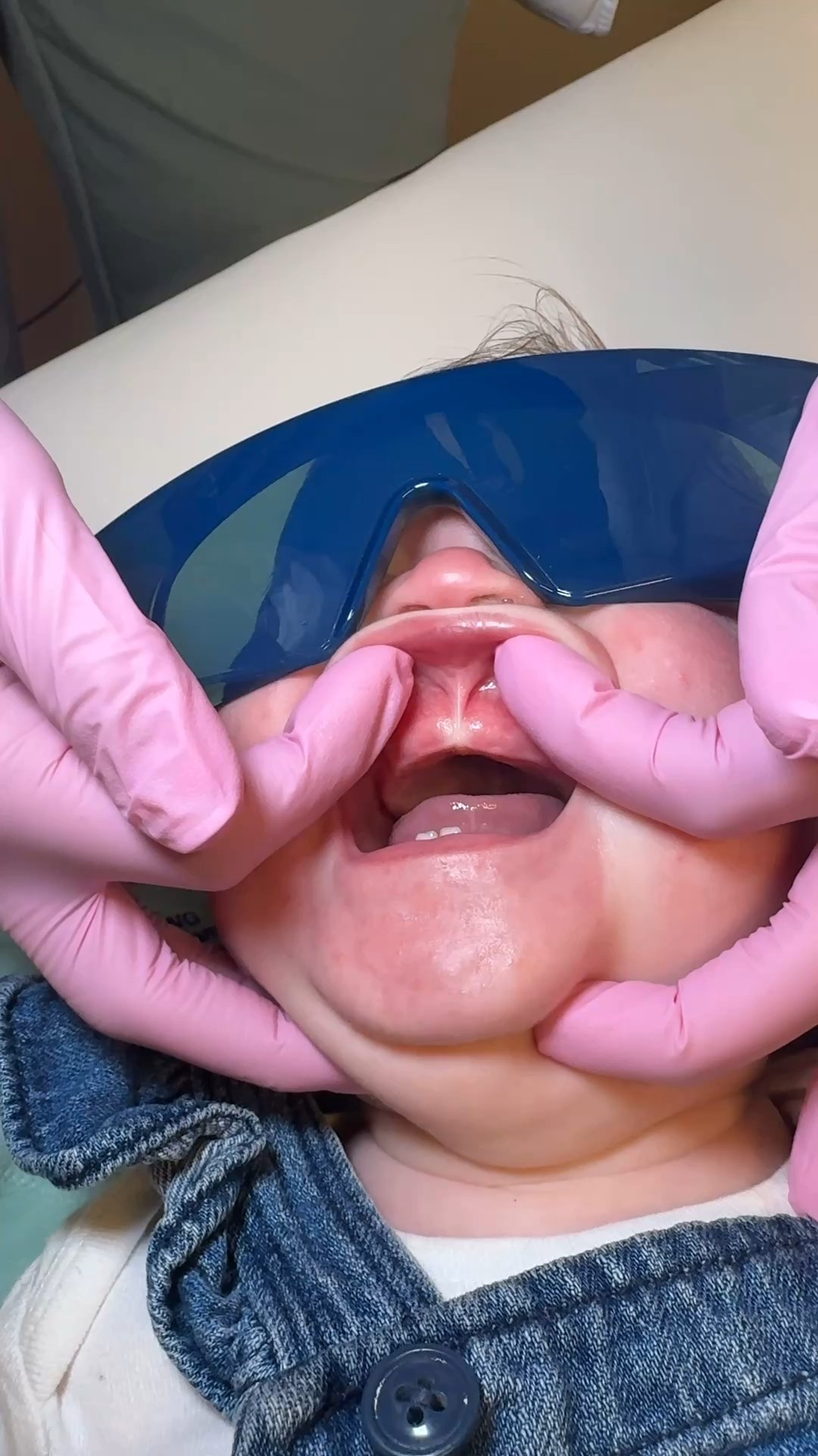 Lip tie procedure homeopathic home remedies for pain 


#LTKKids #LTKBaby #LTKFamily