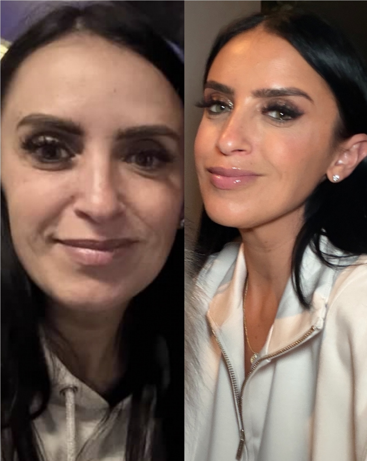 My face used to be swollen from stress until I started using this daily 