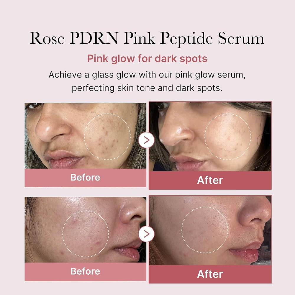 medicube PDRN Pink Peptide Serum, Pink glow serum, Peptide, Niacinamide, Hydrating & Moisturizing... | Amazon (US)