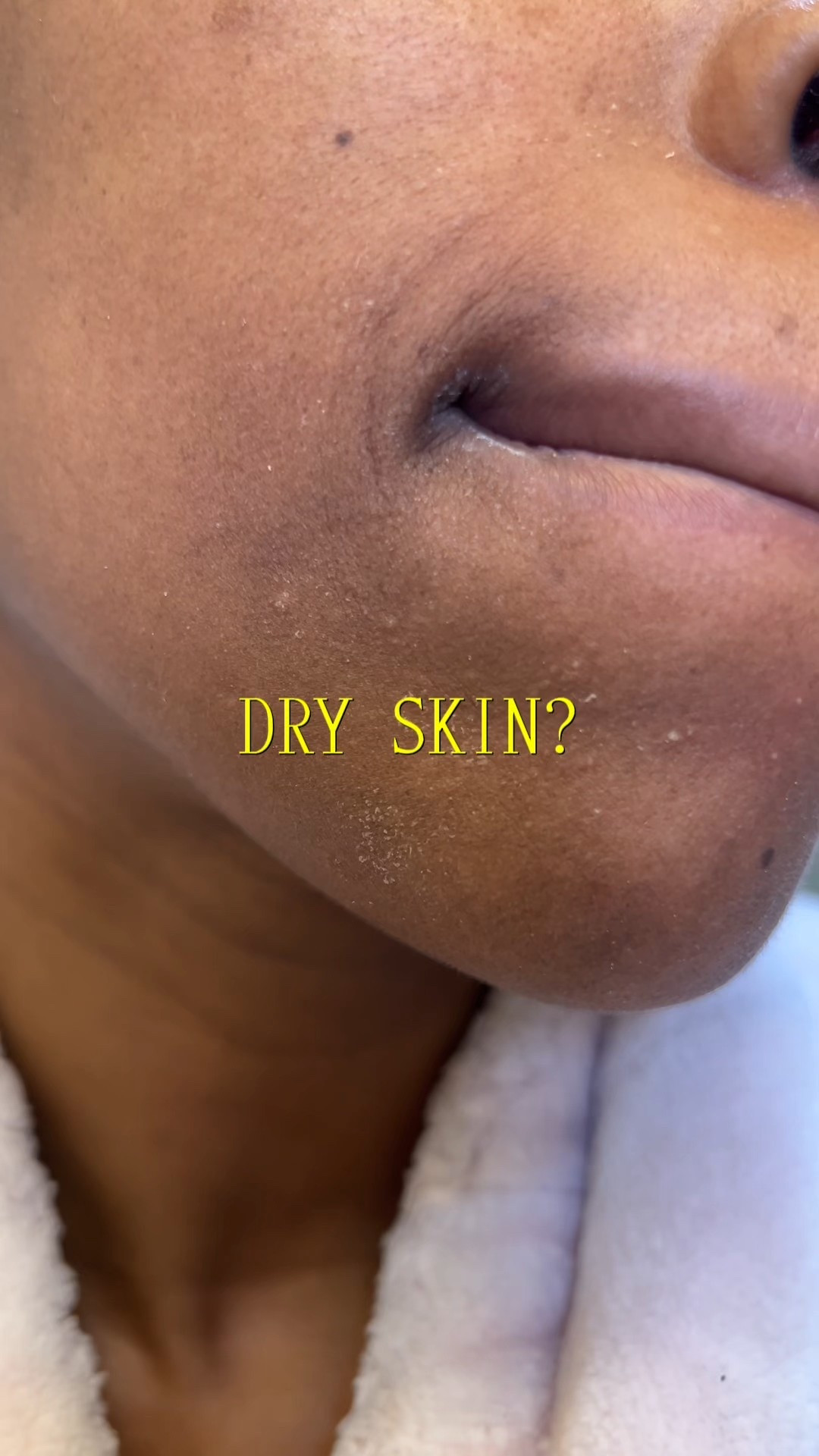 Dry skin girlies unite! 

#LTKBeauty