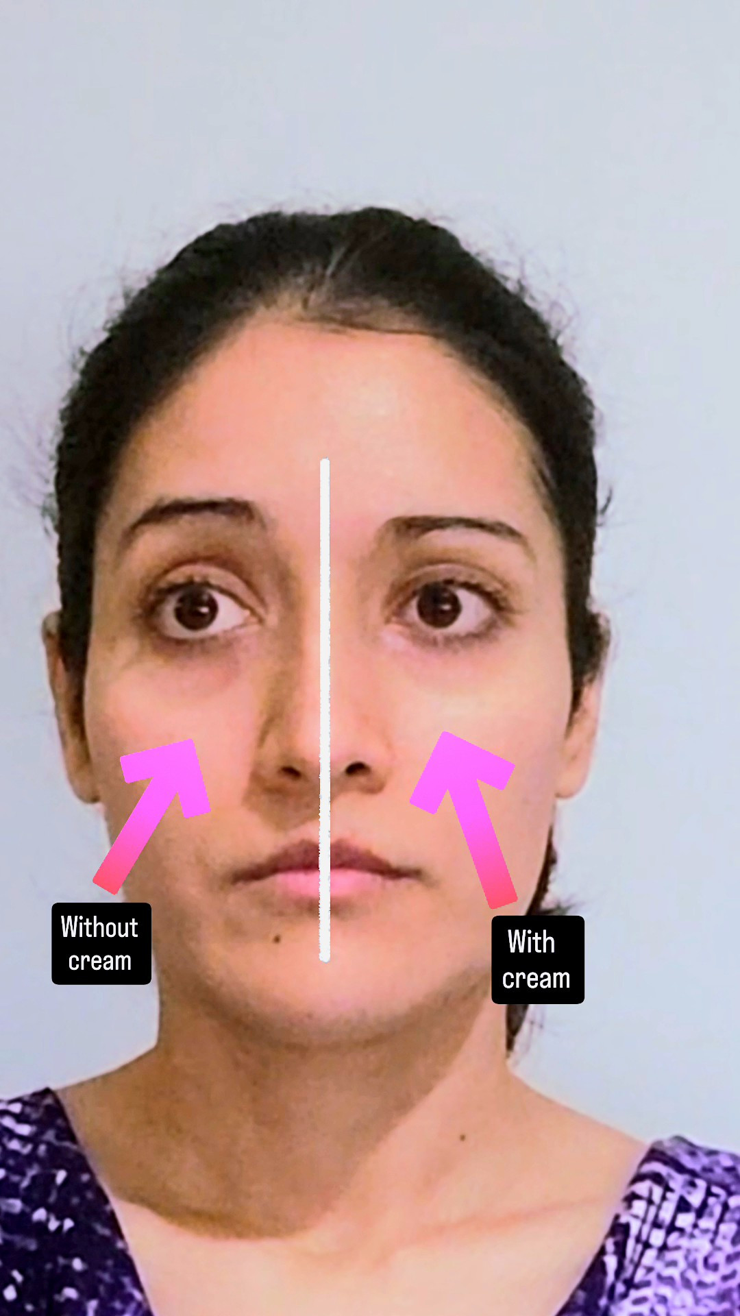 My new favorite lifiting cream!If you're looking for that instant firmness and sculpted look, the Probioderm 3D Lifting Cream is the solution.Rich but fast-absorbing, it hydrates, plumps and lifts your skin in minutes. The refillable jar is a pleasure to use. Go ahead, get that glow!  Yesstyle.com discount code: INFINITEJOYS

#LTKSaleAlert #LTKBeauty #LTKselfcare