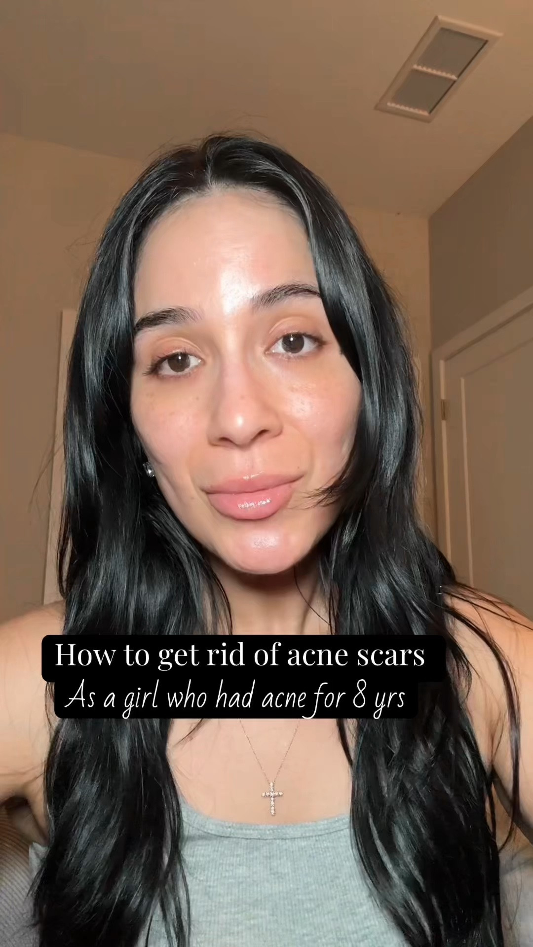 Post laser update and products I’m using while I heal✨ 
￼

#LTKselfcare #LTKBeauty