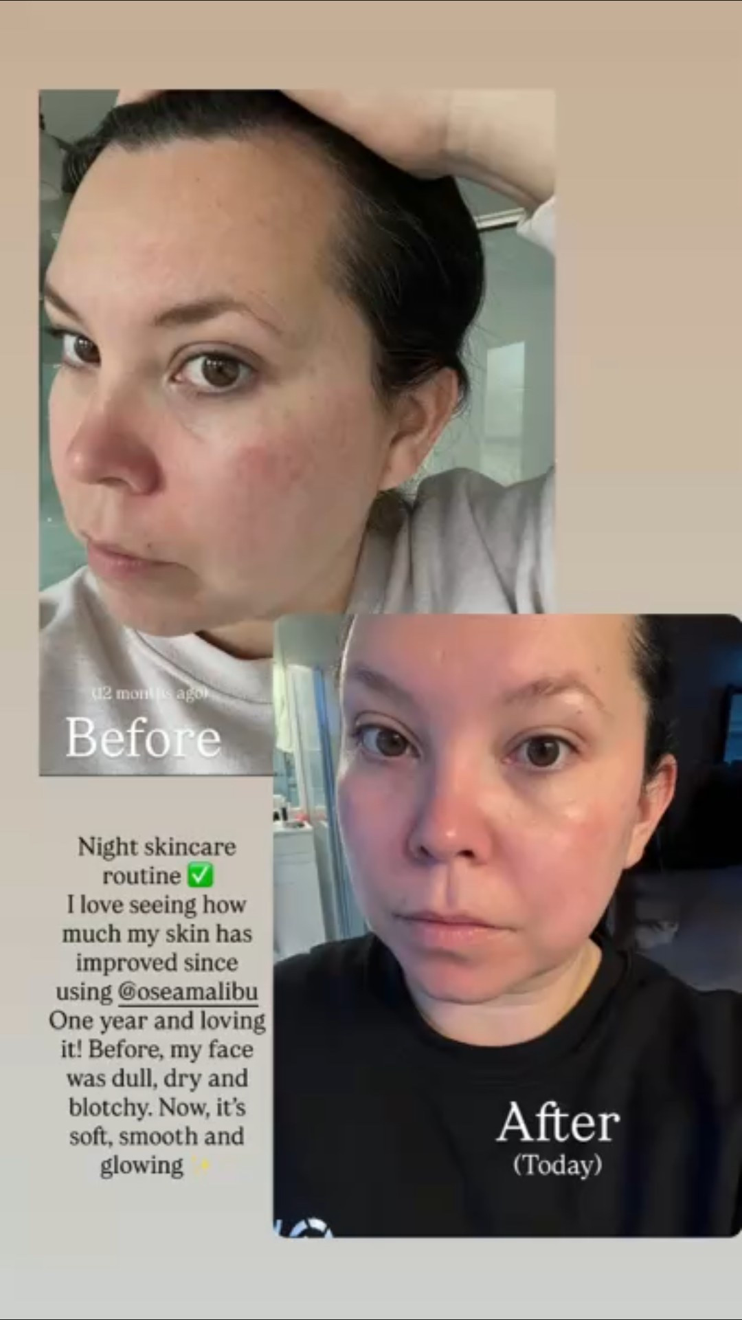 Clean beauty skin before and after 
OSEA discount code: MARISSAMACE10

#LTKselfcare #LTKOver40 #LTKBeauty