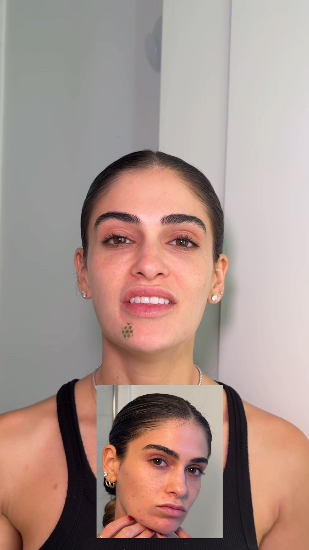 Acne skincare routine 

#LTKU #LTKBeauty