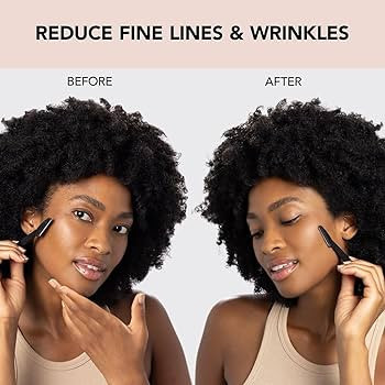 Kitsch Dermaplaning Tool - Face Razors for Women | Eyebrow Razor & Face Shaver for Women | Facial... | Amazon (US)