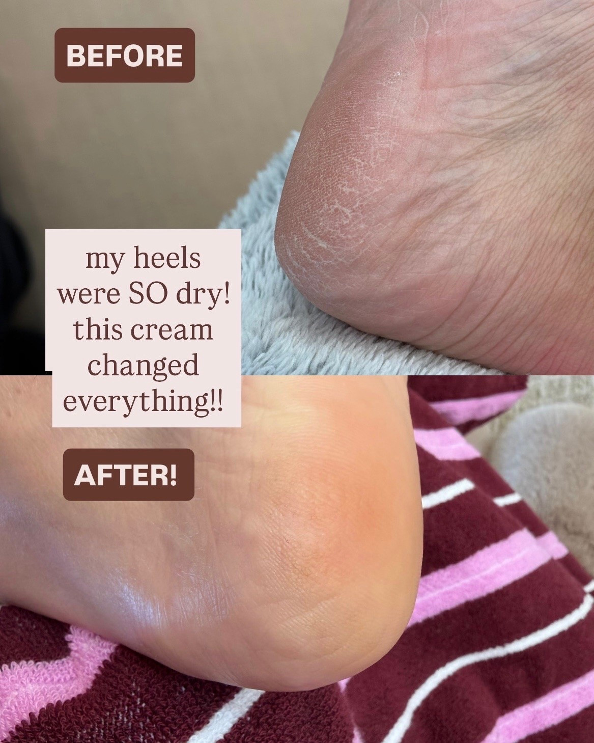 This cream has been a game changer for my dry cracked heels! Obsessed!

#LTKselfcare #LTKBeauty #LTKOver40