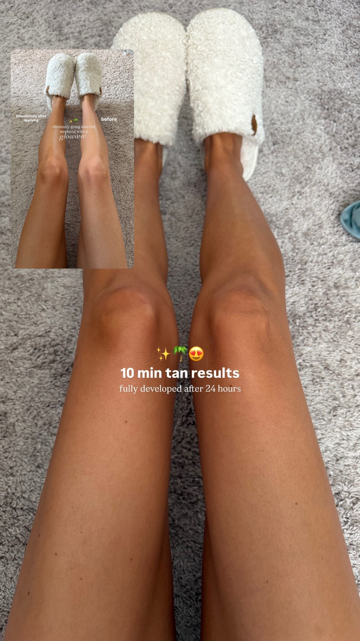 10 min tan results after 24 hours! It’s sooooo gorgeous, smoothing, hydrating and streak free! 

#LTKselfcare #LTKBeauty #LTKgrwm