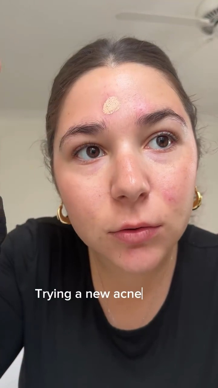 No bc why did my pimple get SMALLER throughout the day?! Lmk if I should try the foundation next🤭

@get.methodiq 

#acnesafemakeup #acneproneskin #acnejourney #acneskincare #acnemakeup