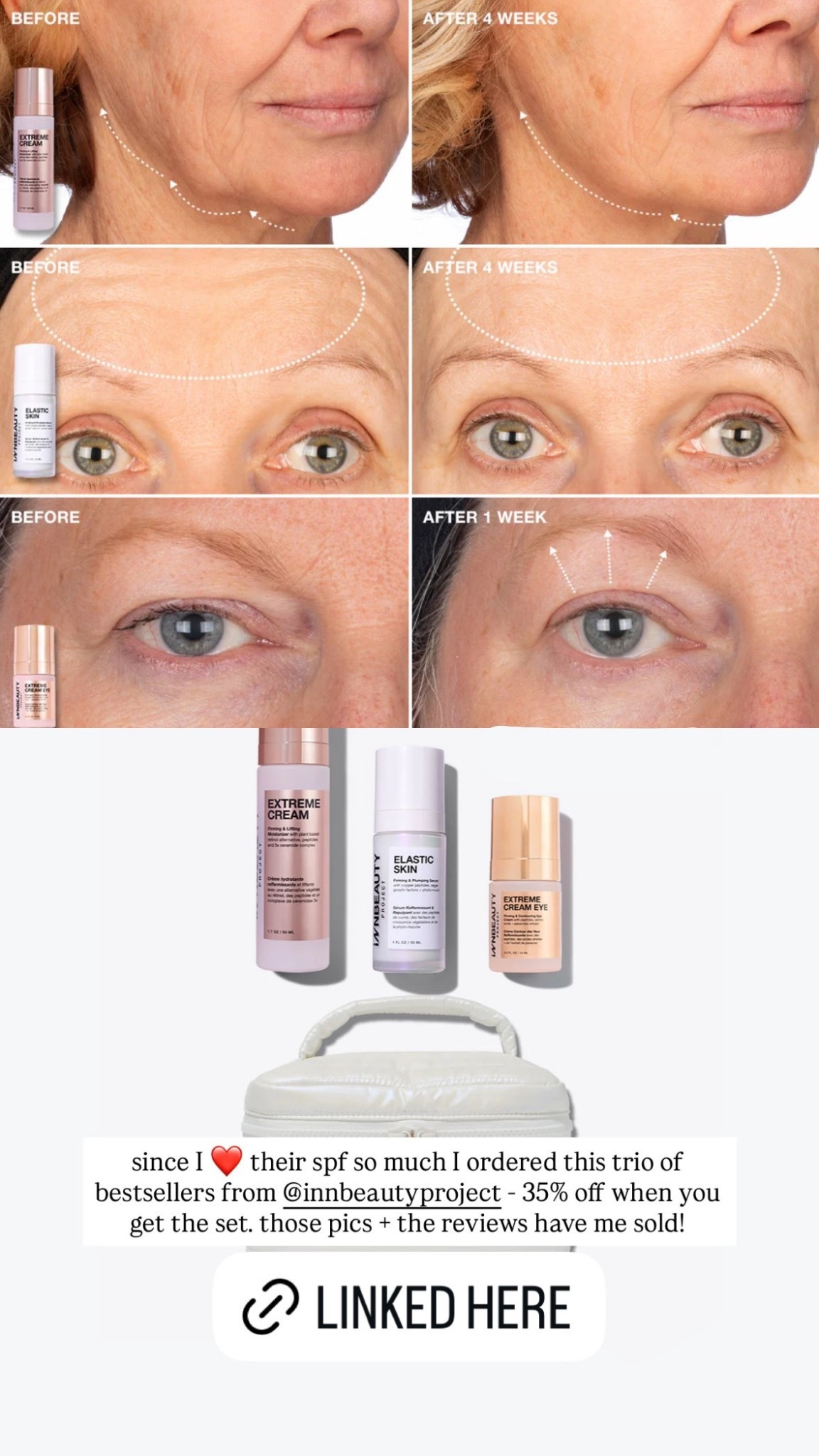 since l ❤️ their spf so much I ordered this trio of bestsellers from innbeautyproject - 35% off when you get the set. those pics + the reviews have me sold!

#LTKBeauty #LTKGiftGuide #LTKHoliday