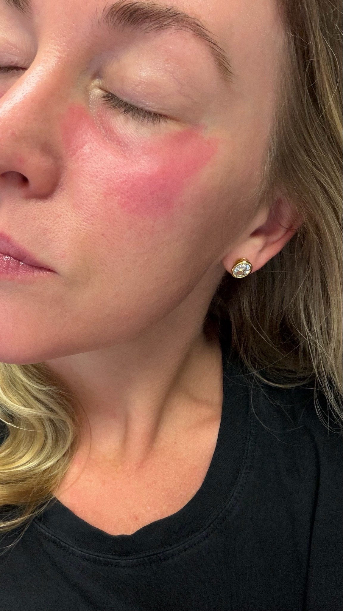 Do your homework before you try it 🤪

This viral product isn’t meant for everyone. 

#viral #roc

#LTKdayinmylife #LTKselfcare #LTKstorytime