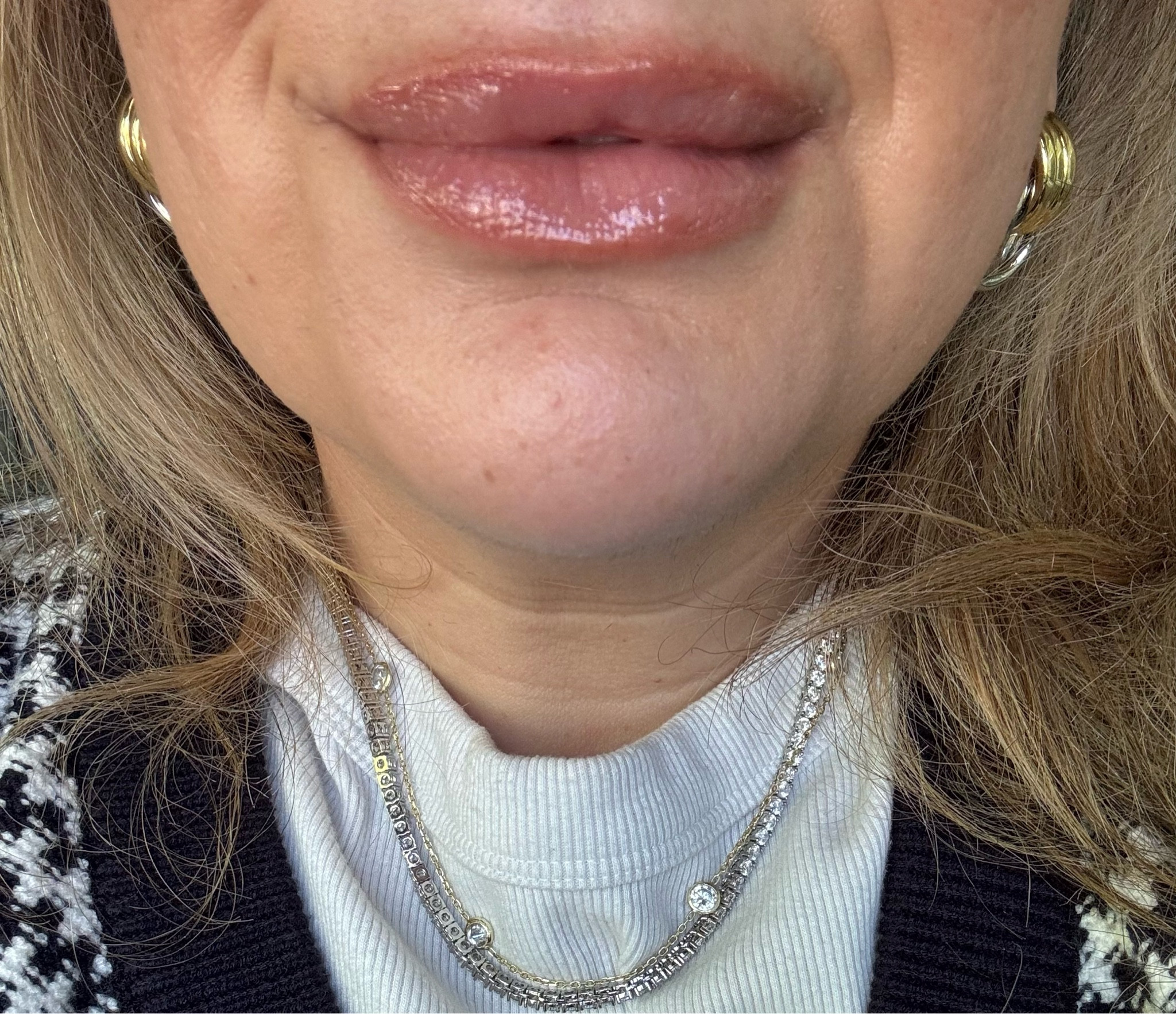 Refy lip blur + superegg infinite layers lip care is the perfect combination for plump, luscious lips that look like you just got them done! I’m obsessed  

#LTKStyleTip #LTKBeauty #LTKGiftGuide