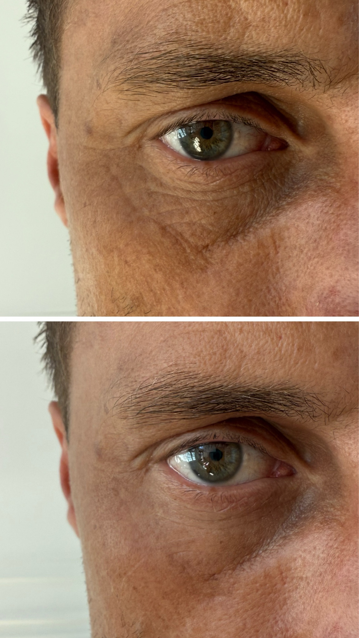 The amazing before & after when Cody used the summer Fridays jet lag eye patches just one time 🤯 these are the best at smoothing out under eye wrinkles and brightening the skin! They’re on sale up to 20% off right now with code: SAVEMORE 〰️

Sephora sale, eye patches, summer Fridays 

#LTKMens #LTKBeauty #LTKSaleAlert