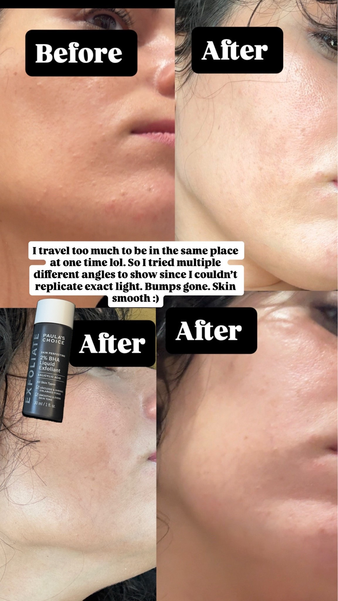 Bha from Paula’s choice that cleared up my acne so fast. 

My favorite part is that as much as I try to be a skin addict, I’m simply not smart enough to get things right so I tend to trust science backed, clinical tested, proven results brands which is what Paula’s Choice is.

#LTKmorningroutine #LTKBeauty