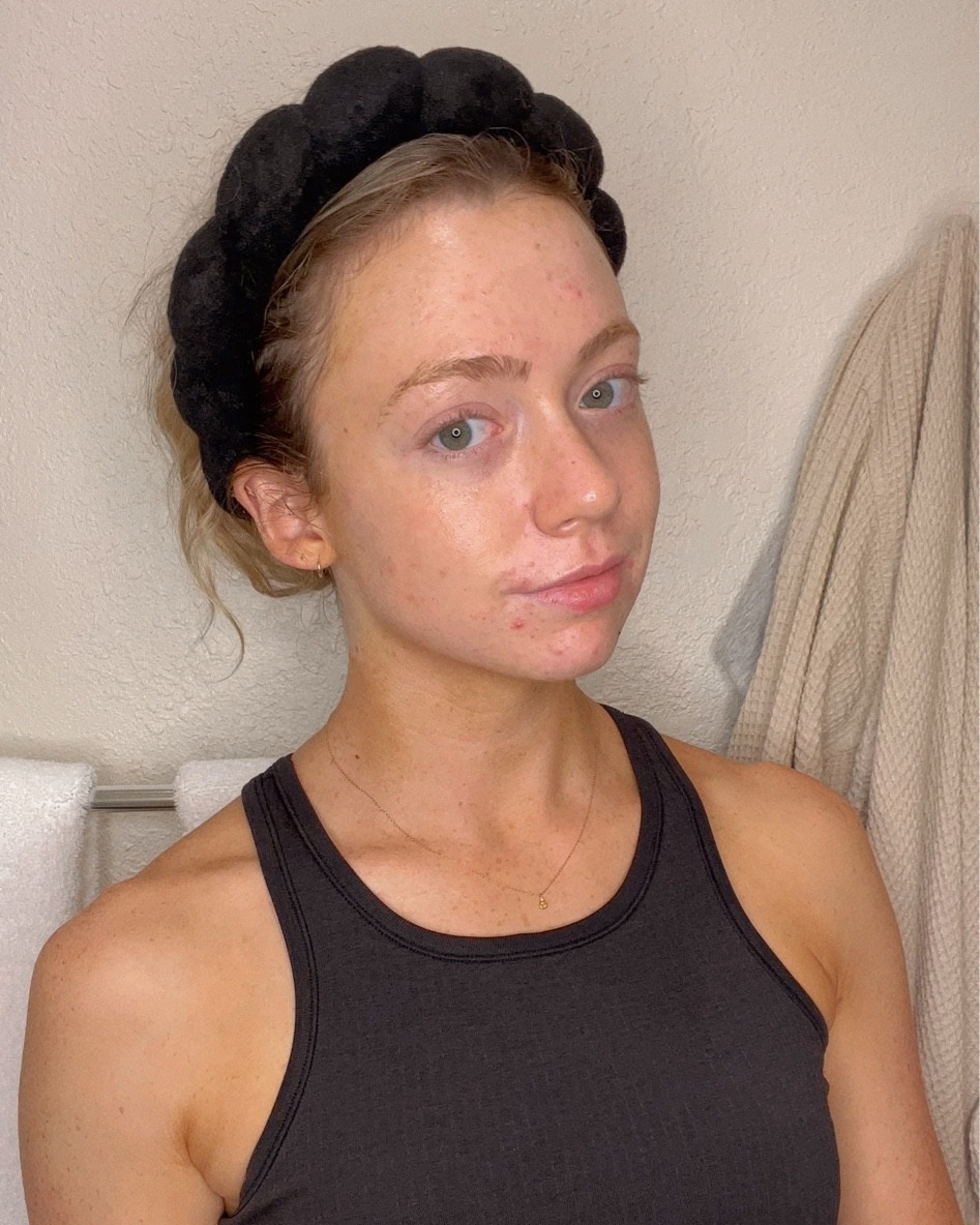 Nighttime Skincare routine for hormonal acne! 

#LTKbeauty #LTKFind #LTKunder50