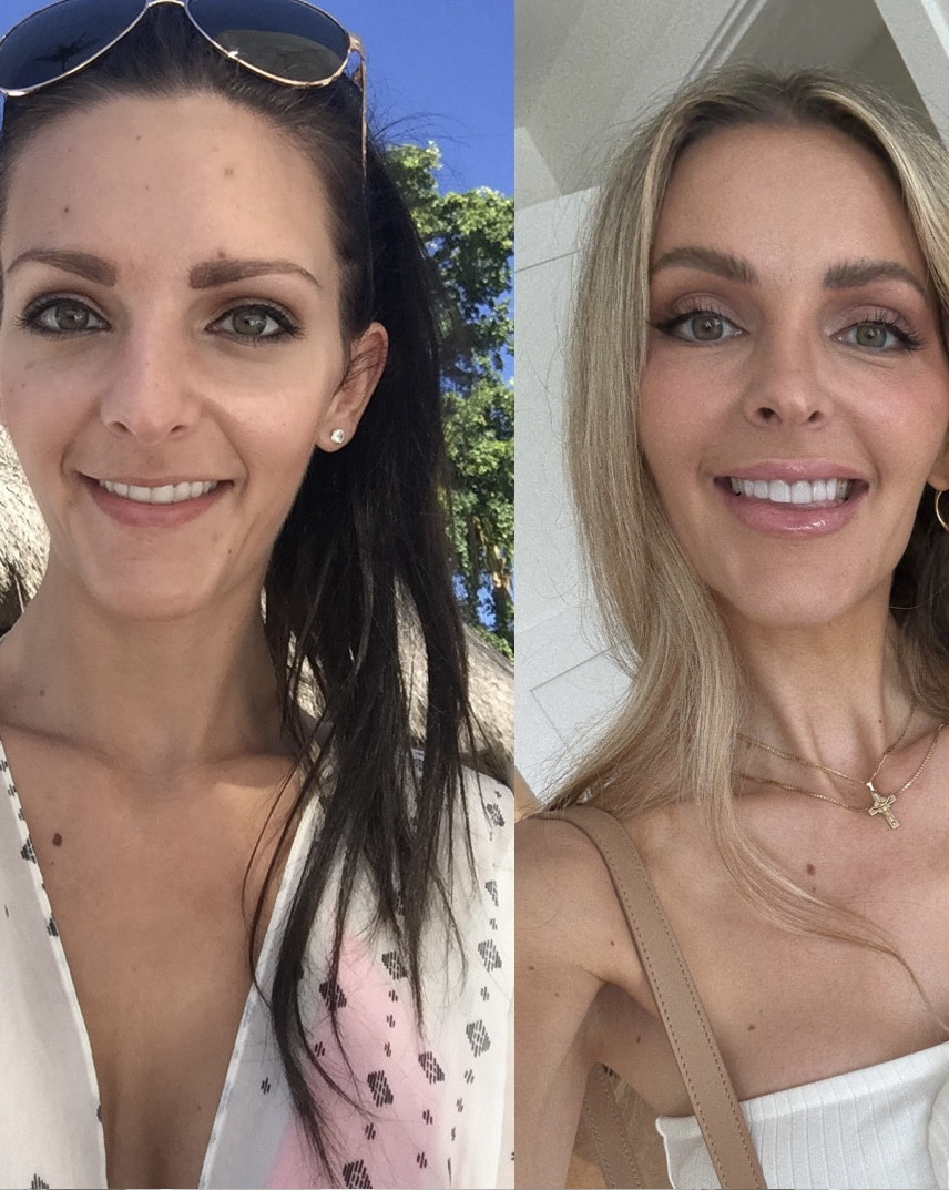 My must have supplements to look and feel better at 40 than I ever did at 30 💅 

#LTKOver40 #LTKActive #LTKBeauty