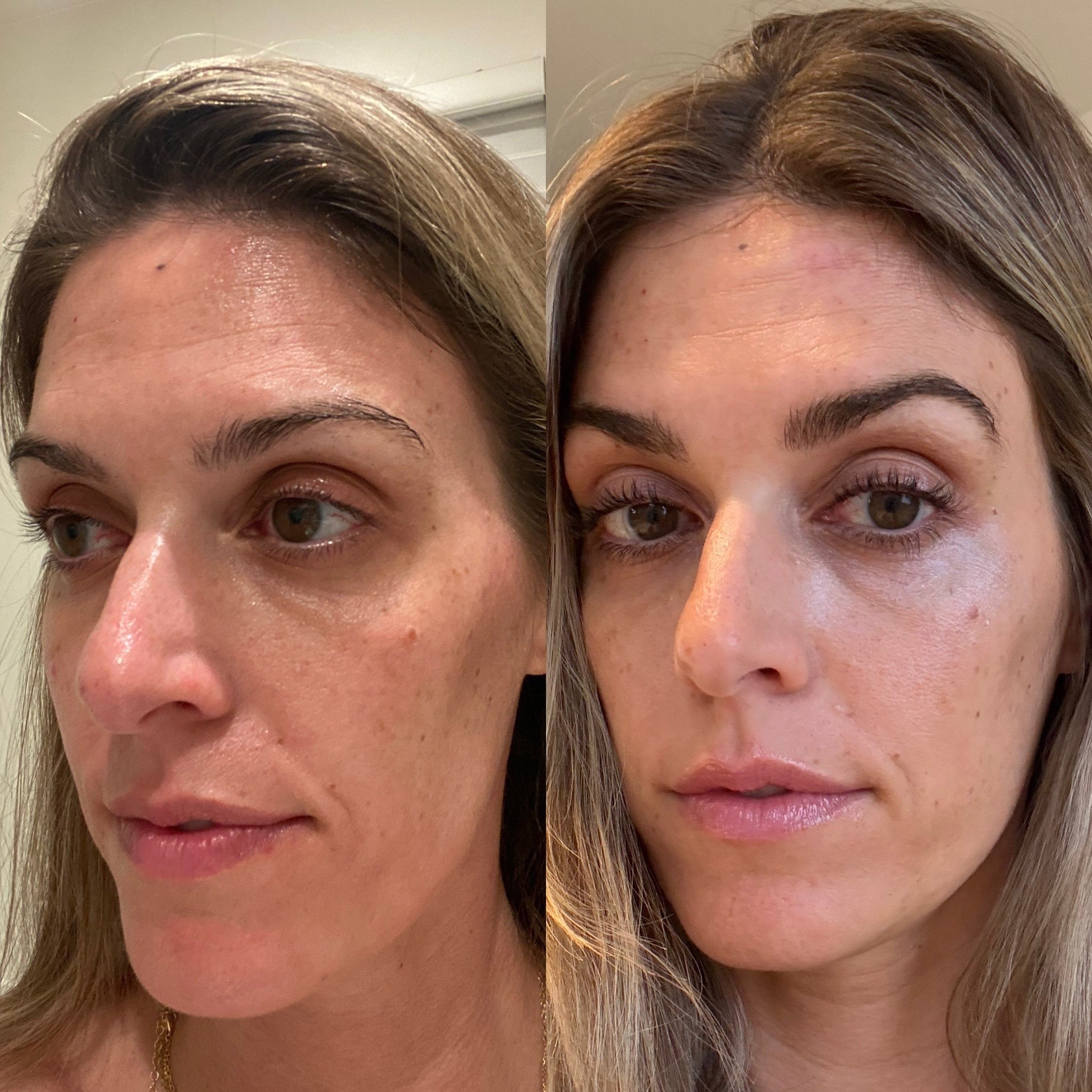 Amazon Prime Sale find! 
25% off Babe Original serums
My eyelash and eyebrow serum I use daily is currently on sale! This is usually when I stock up 👍🏼 Within 4-6 weeks I noticed a huge difference in my eyebrows and eyelashes and there’s no turning back! I’ve been using these serums for almost a year now. I use the growth serums at night and the conditioner in the morning. They also have a serum for anyone with sensitive eyes as well. Right now they’re in the $30 range which is 3x less than what I was spending on a different serum I used to use. 

Babe original, eyelash serum, eyebrow serum, beauty product must haves, long lashes, eyebrow products, everyday beauty products, get ready with me

#LTKSaleAlert #LTKselfcare #LTKBeauty