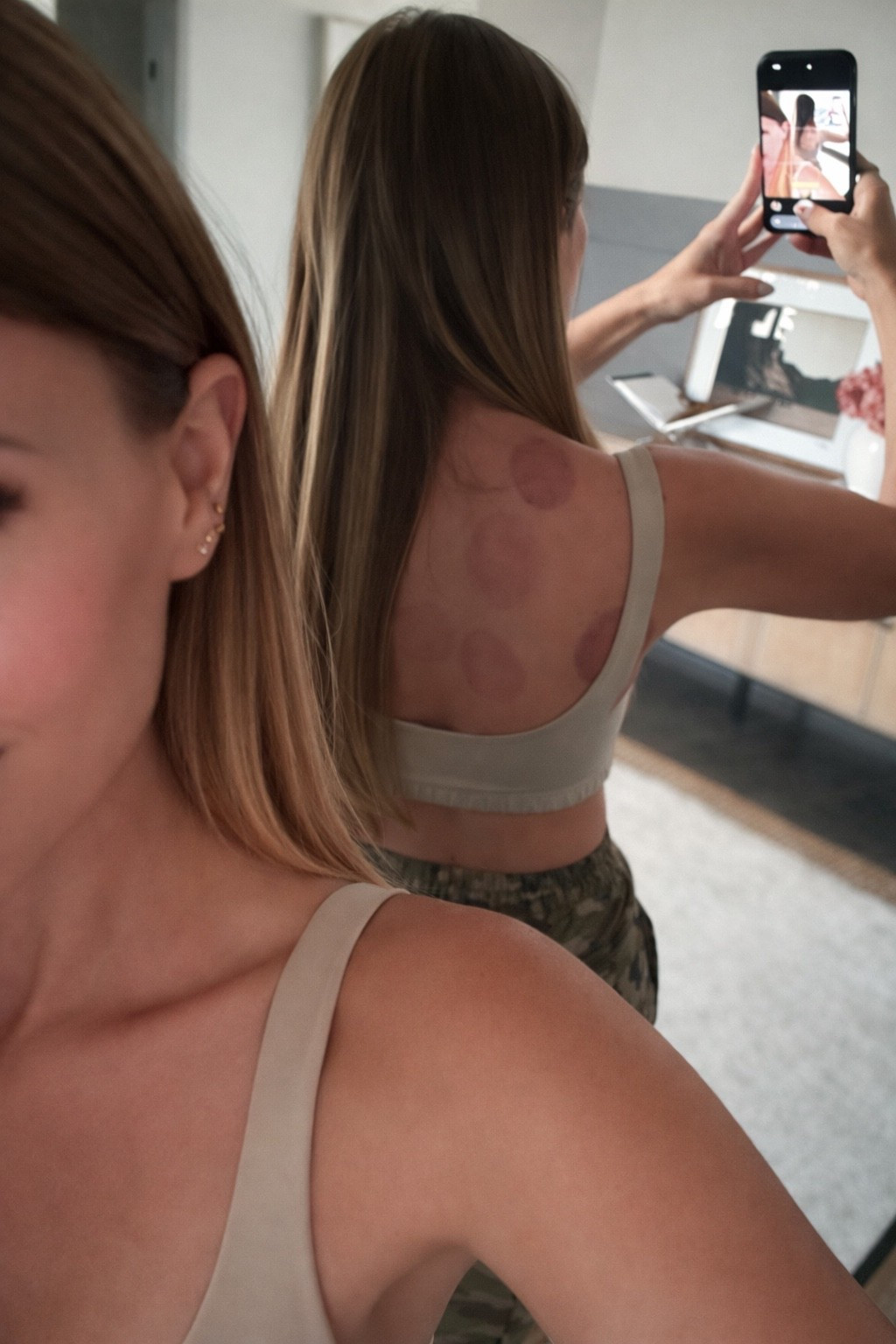 Cupping has become a core part of my muscle recovery & wellness routine between monthly massages. It helps support circulation, lymphatic drainage, fascia release & tension relief, especially after strength training, Pilates, long walks, or high stress weeks.

I’m tagging the two at home cupping devices I personally use for post workout recovery. One is a traditional full set for targeted myofascial release & deeper muscle work. The other is a smart cupping device with red light therapy for enhanced circulation support & inflammation reduction. Both are easy to use at home & perfect for building a consistent recovery routine without constant appointments.

If you’re focused on fitness recovery, biohacking wellness, hormone supportive routines, lymphatic health & an active lifestyle, recovery tools matter just as much as the workout. Strong body & smart recovery go together.

cupping therapy - at home cupping device - smart cupping massager - red light therapy recovery - muscle recovery tools - lymphatic drainage routine - fascia release - myofascial release therapy - post workout recovery - fitness recovery essentials - holistic wellness routine - inflammation support - circulation boosting tools - active lifestyle routine - gym recovery must haves - self care & recovery - wellness girl routine

#LTKOver40 #LTKfitnessgoals #LTKActive