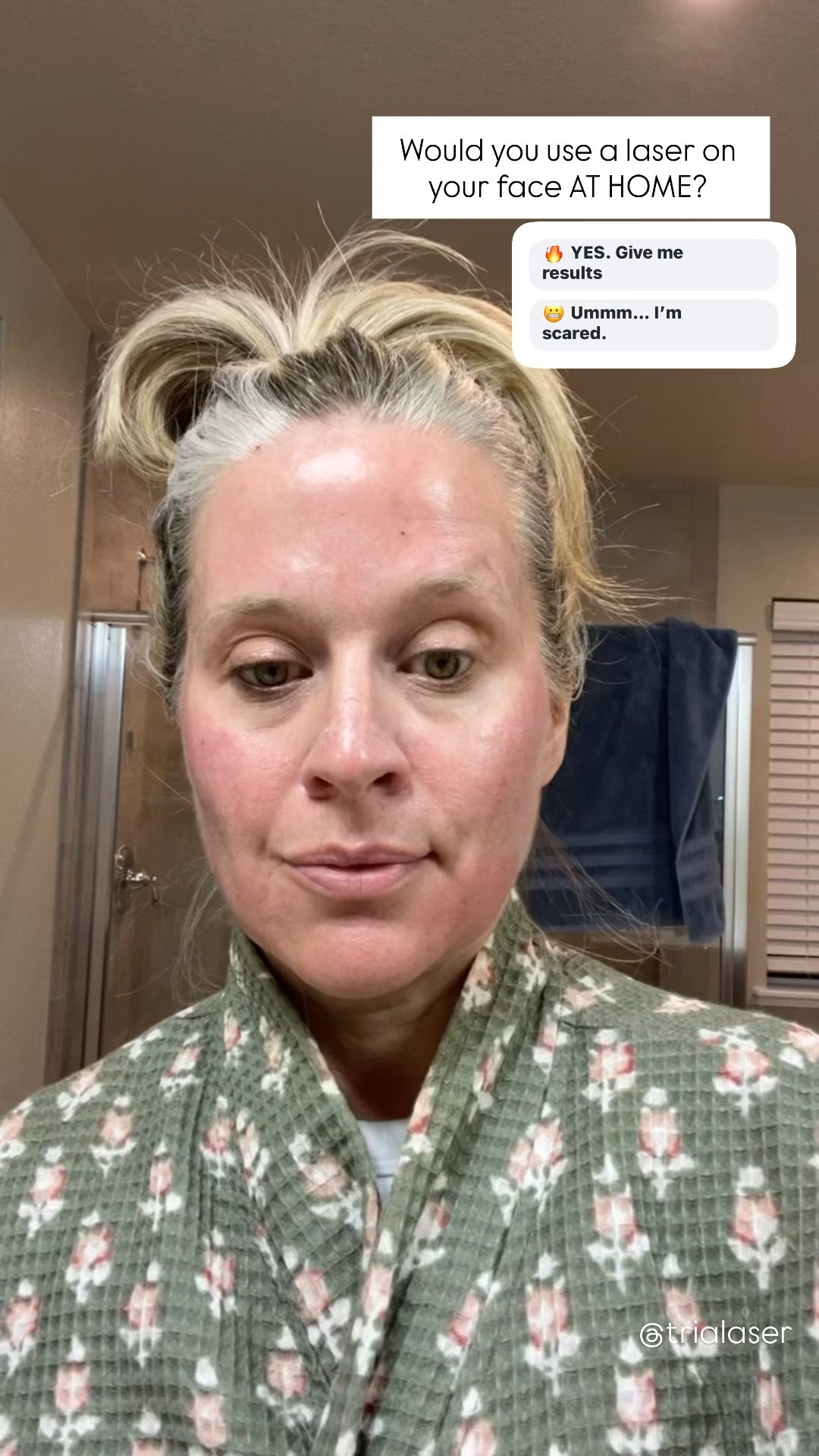✨Tap the bell, save and ❤️ start here over 40 fashion, midlife style, midsize fashion and luxury looks for less.  

At 48, I’m not looking for skincare that just makes my skin feel soft. 👀 I want to actually see a difference.

I’m testing the Tria FRX at home fractional laser 5X a week and watching my dark spots, pigmentation, uneven skin tone, fine lines and overall skin texture.

It uses fractional laser technology to support new skin cell creation, collagen production and skin elasticity.

I’m taking you along because I want to see what it actually does to real 48 year old skin. 😂 Stay tuned. 👀

Save 10% code OVERFORTY


👑 Helping you look good, feel good.-Lindsey Denver   Check back daily for belly-friendly style, confidence, and Outfit Physics™.

#LTKOver40 #LTKMidsize #LTKBeauty