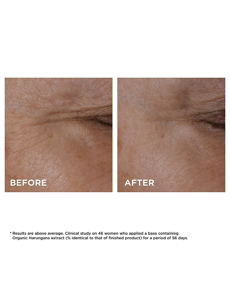 Total Eye Lift Firming & Smoothing Eye Cream | Saks Fifth Avenue