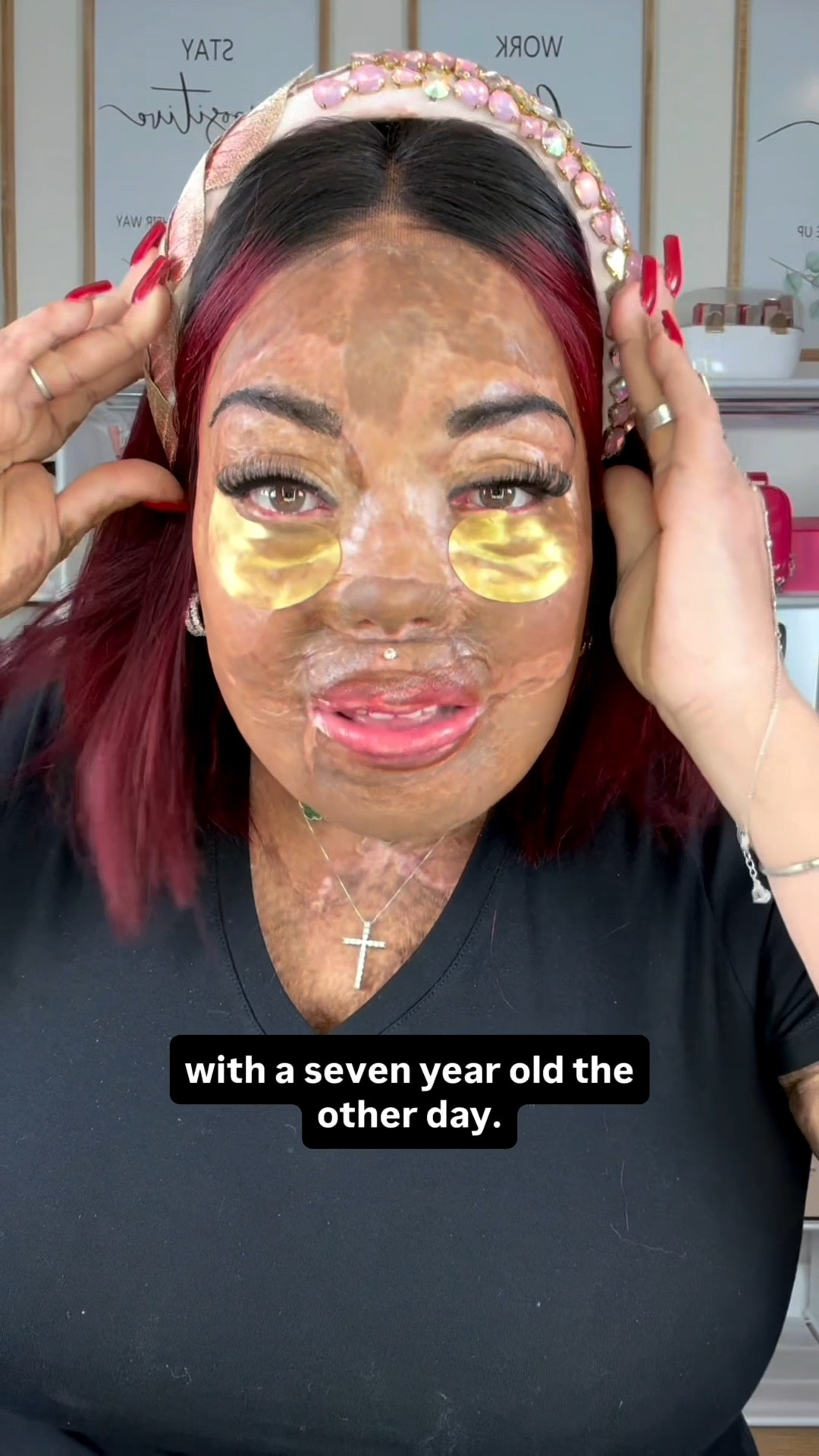 Adults are interested in my story. Kids are interested in me.🦋 

Love y’all!😘

✨My Burn Survivor Skincare Routine

@peterthomasrothofficial Gold Eye Masks
@alliesofskin Molecular Saviour Probiotics Treatment Mist
@elevaiskincare Enfinity Exosome Regenerative Serum
@alliesofskin Multi Peptides & Growth Factor Advanced Lifting Serum
@alliesofskin Copper Tripeptides & Ectoin Advanced Repair Serum
@alliesofskin Tranexamic & Arbutin Advanced Brightening Serum
@alliesofskin Peptides & Antioxidants Advanced Firming Daily Treatment 
@alliesofskin CE15 Bakuchiol Firming Oil

You don’t need ALL of these! Visit us.allies.shop to find your routine and shop 20% OFF Code: BurnedBeautyAOS 

beauty, skincare over 40

#LTKOver40 #LTKBeauty
