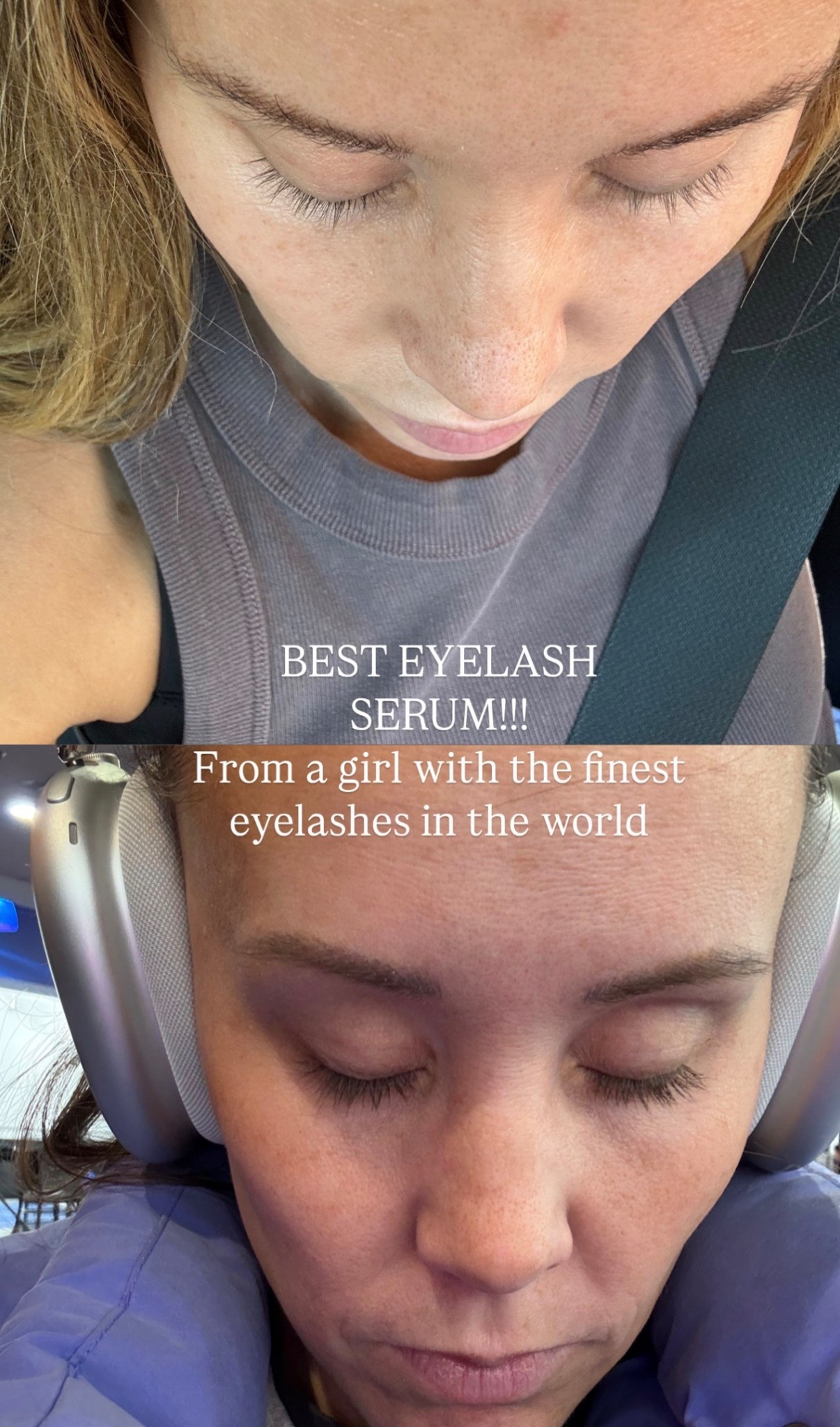My fav eyelash serum on sale for Amazon Big Spring Sale! Love this product so much😍 it has absolutely transformed my lashes!! 

#LTKBeauty #LTKSaleAlert #LTKgrwm