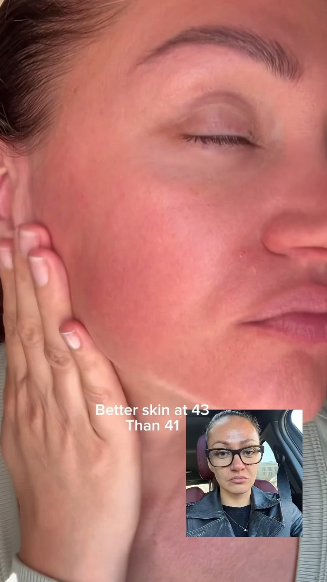 Better skin in 43 than 41 

#LTKselfcare #LTKOver40 #LTKBeauty