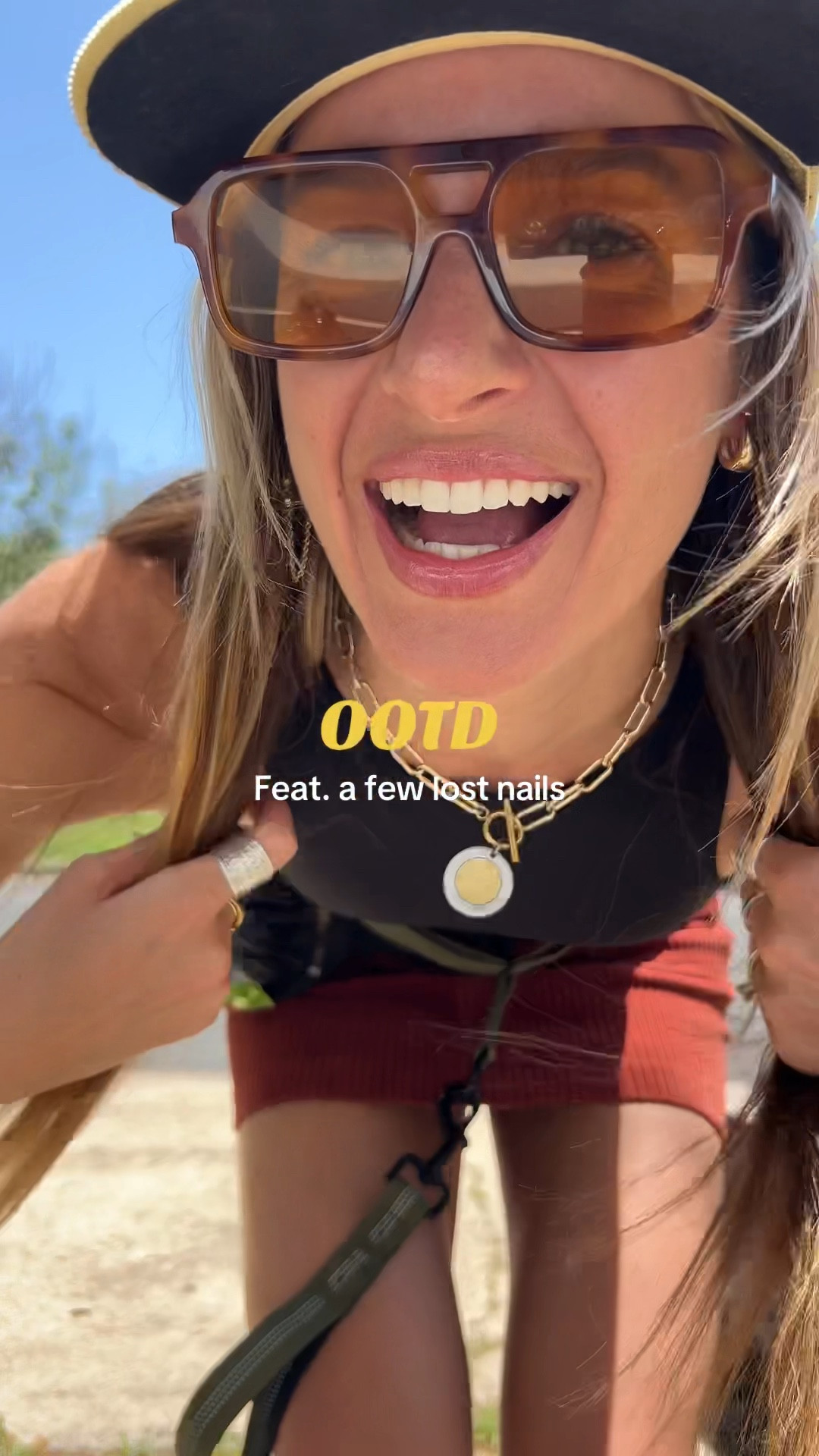 Normalize imperfect nails 🙂‍↔️⚡️

#LTKShoeCrush #LTKStyleTip #LTKFestival