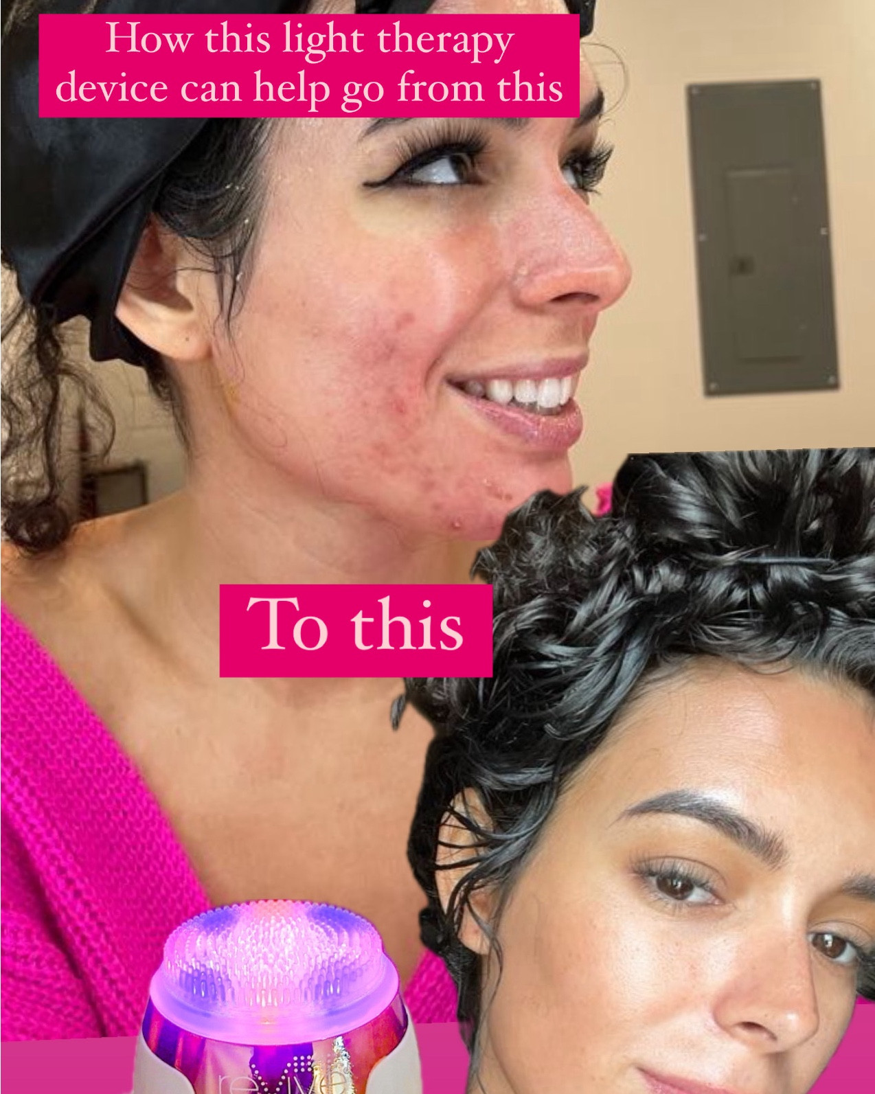 #ad This ReVive Light Therapy Sonique Mini Cleanser is the perfect travel go to for anyone suffering from acne and wanting to decrease wrinkles. My acne journey including multiple procedures at the medspa and one of them was blue light therapy (and there’s actual data that blue light therapy works, it’s not just another marketing ploy). 

Use code JESSICA20 for 20% off

What I like about this is how easy it is to spot treat, take on the go when I’m traveling, and how affordable it is compared to going to the medspa and even other skin devices. 

I also like this more than a mask, because of the ability to spot treat certain areas and because I don’t need blue light on certain areas like my forehead but I do need it on my chin. So I can apply the blue light only where it’s needed and the red light only where it’s needed. 


#LTKSaleAlert #LTKGiftGuide #LTKBeauty