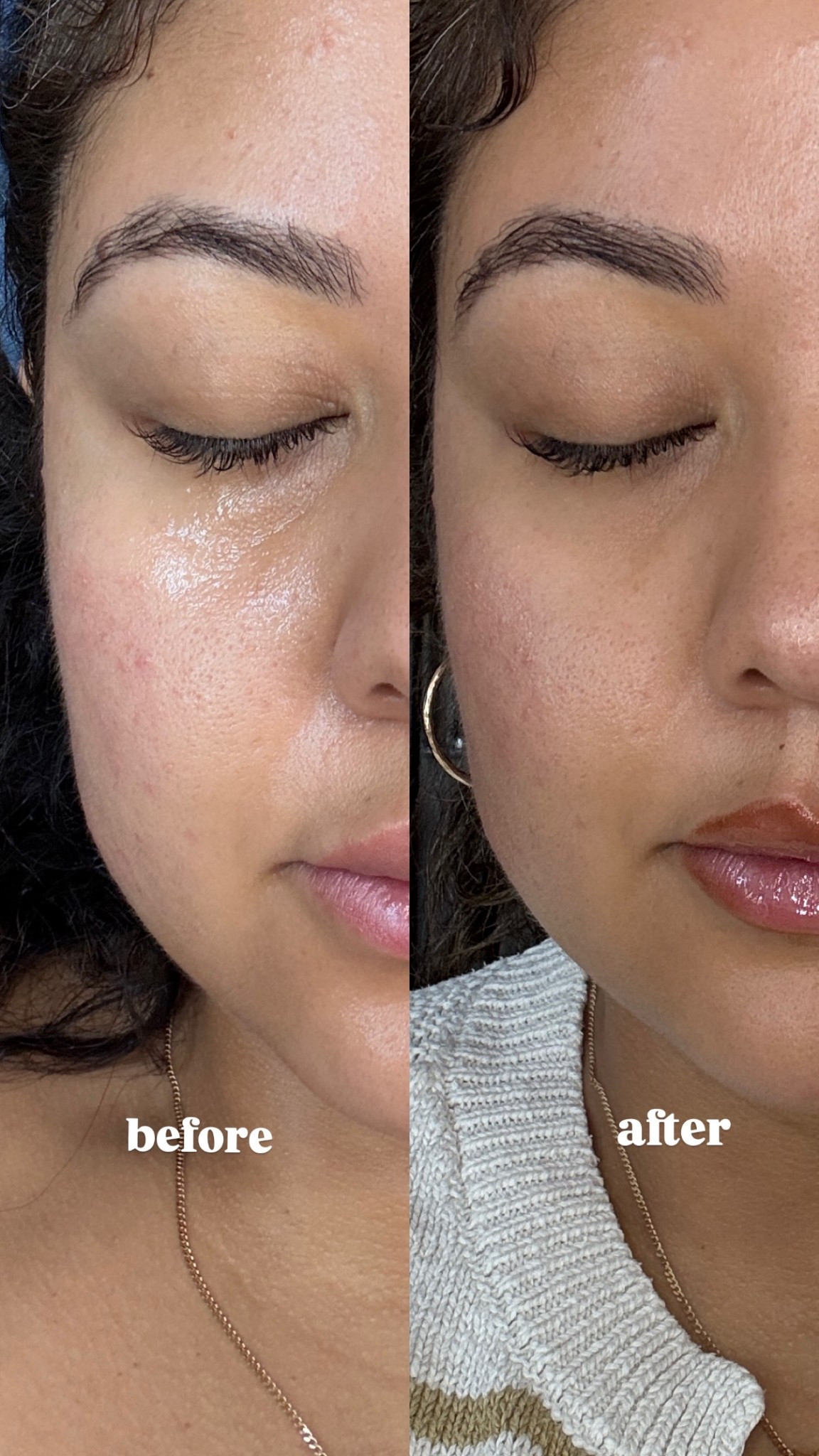 Best eye cream for dark circles

#LTKmorningroutine #LTKBeauty