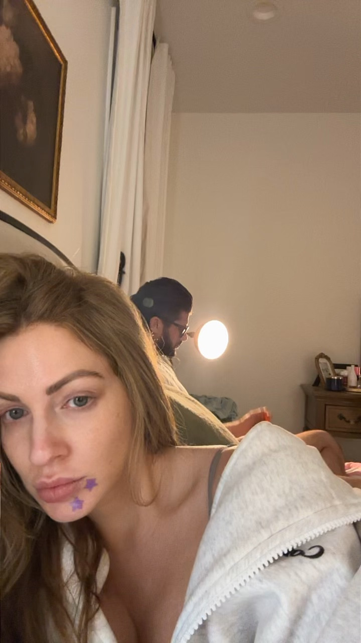 Pimple patches for recovery after pimples have popped and wanting to reduce redness, swelling and heal the area faster! 

#LTKBeauty